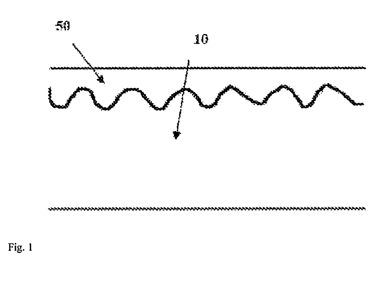 Bioabsorbable medical device or medical device component and preparation method thereof