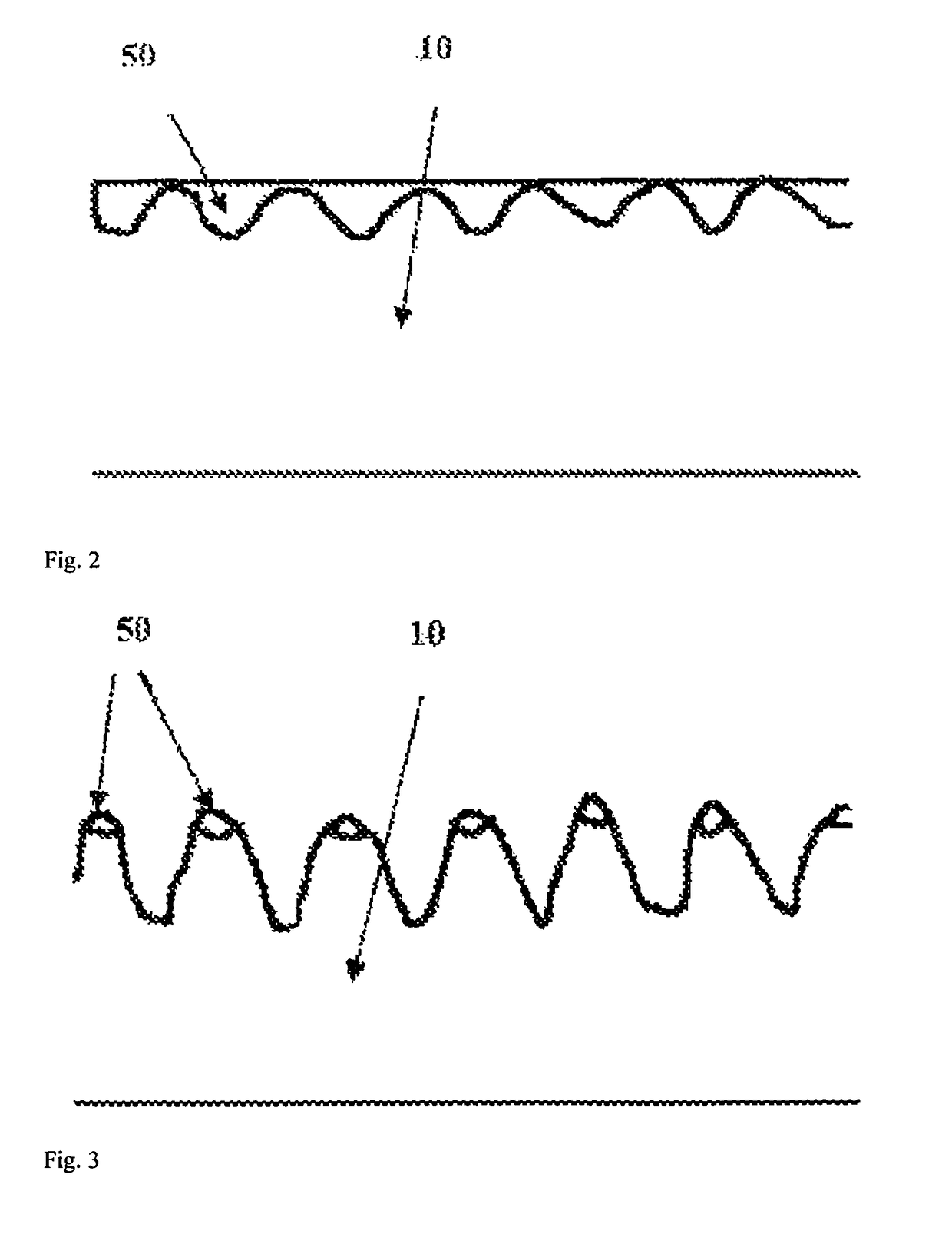 Bioabsorbable medical device or medical device component and preparation method thereof