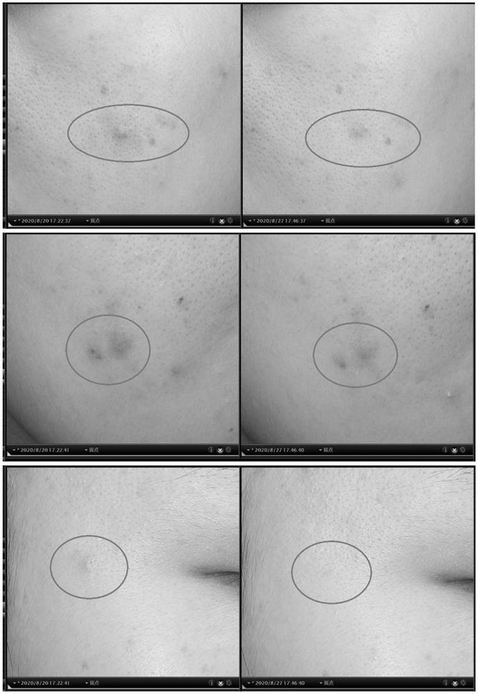 Active protein peptide gene with excellent repairing effect and encoded protein peptide