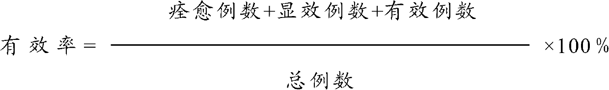 Traditional Chinese medicine composition for treating constipation and preparation method and clinical preparation thereof