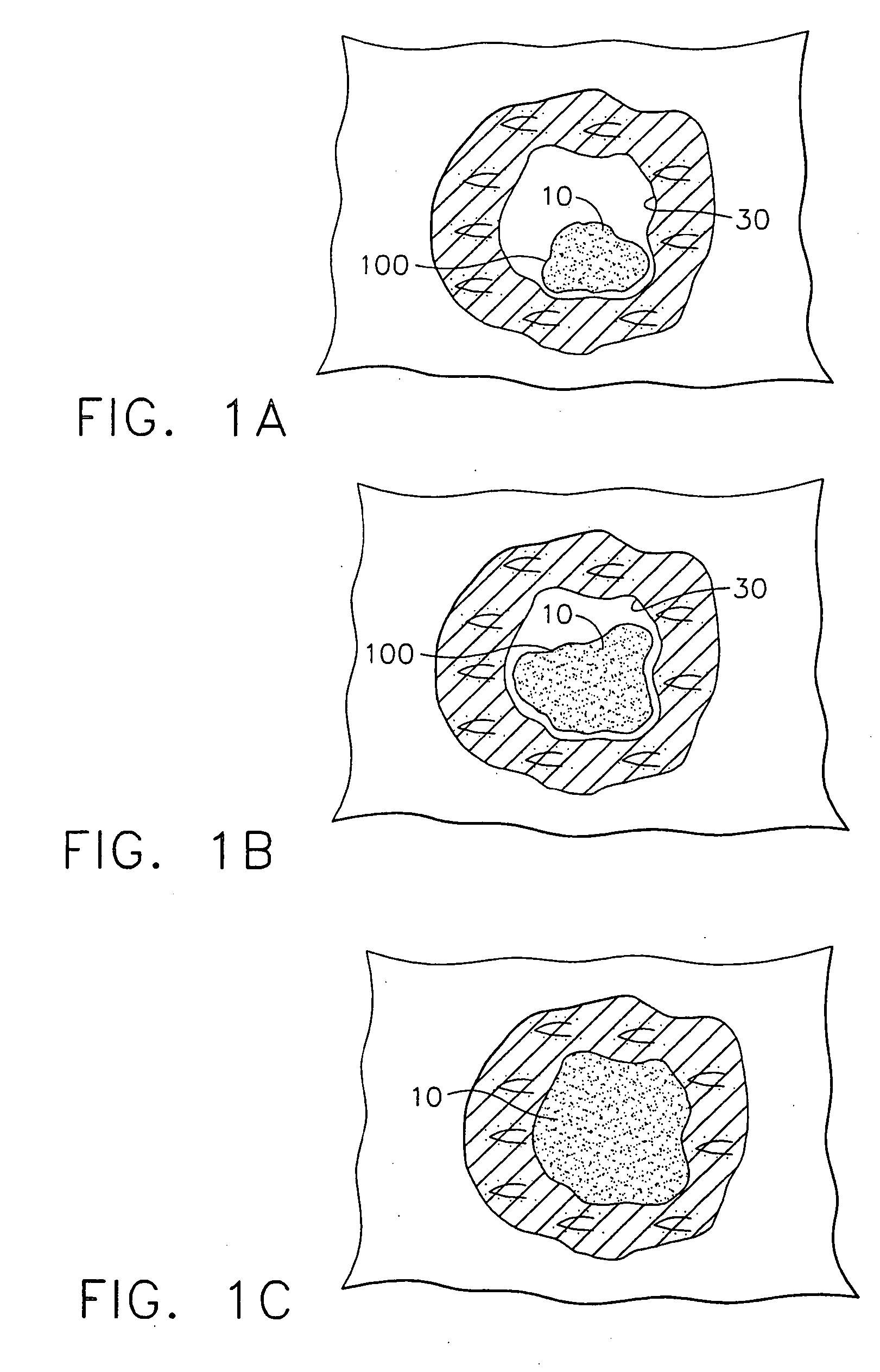 Apparatus and method for marking tissue