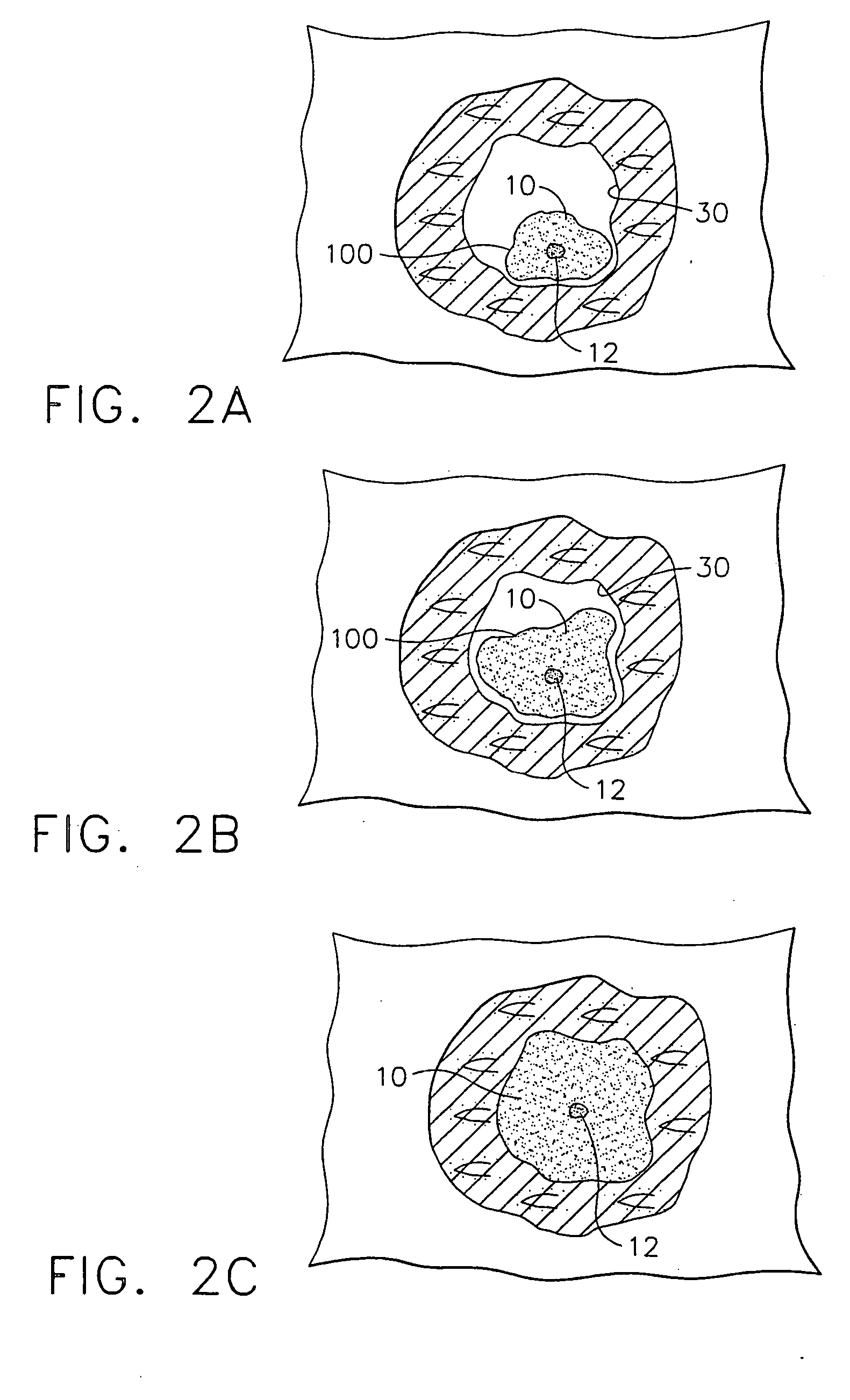 Apparatus and method for marking tissue