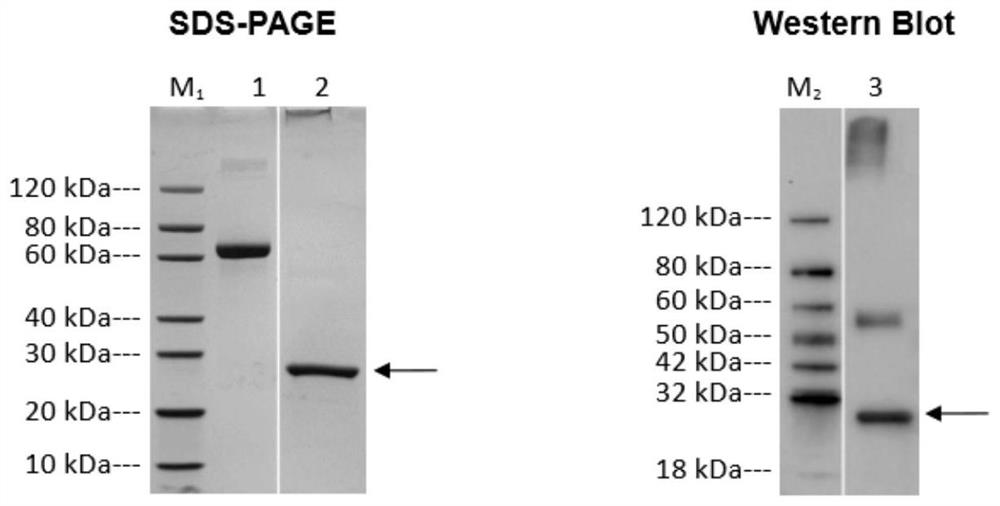 Preparation method of B7-H4 protein and application of B7-H4 protein in preparation of drugs for resisting excessive immune response or cytokine storm