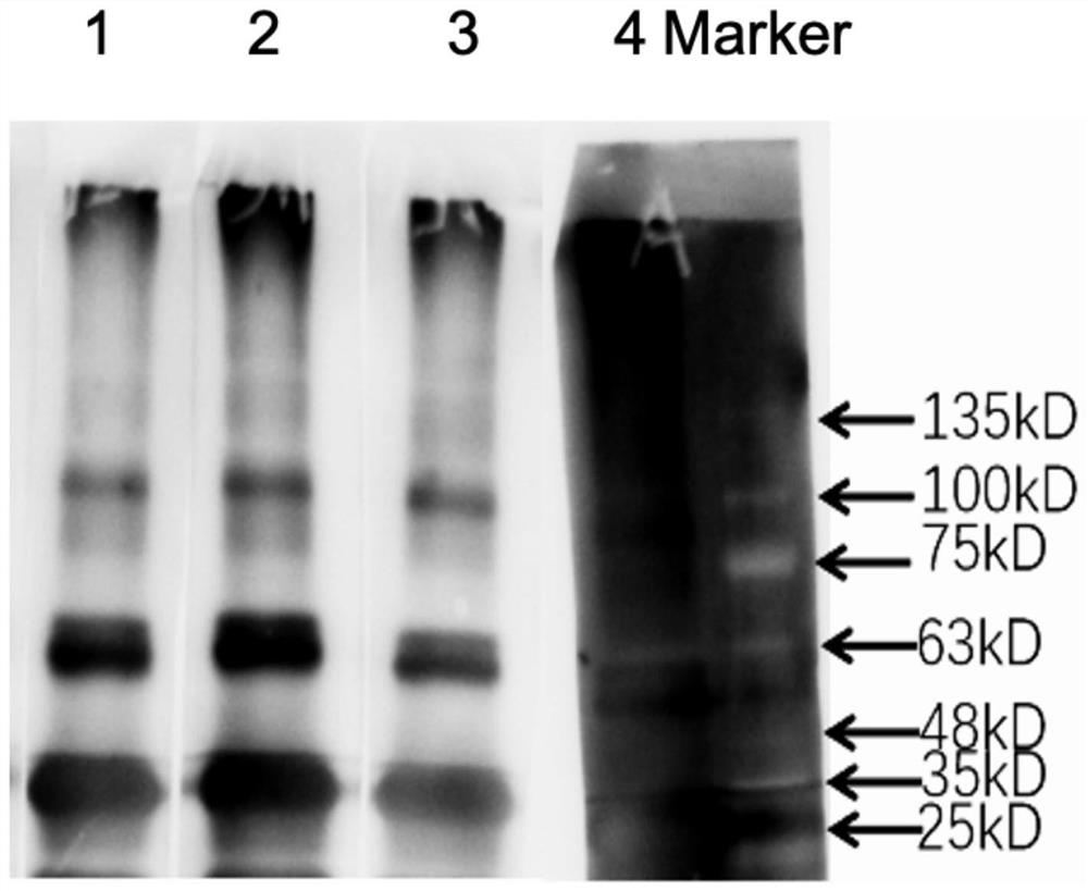 Preparation method of B7-H4 protein and application of B7-H4 protein in preparation of drugs for resisting excessive immune response or cytokine storm