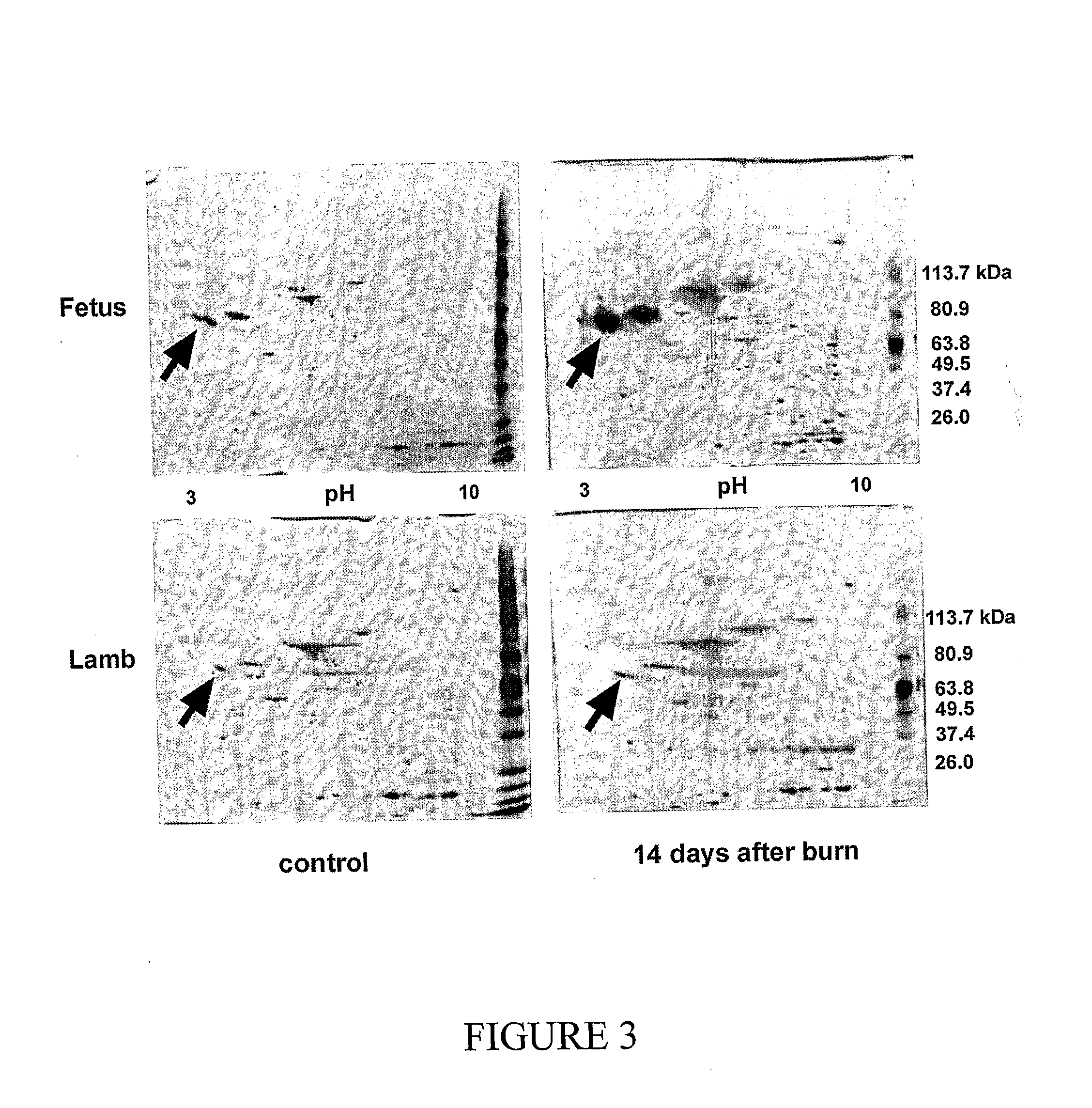 Method of treatment