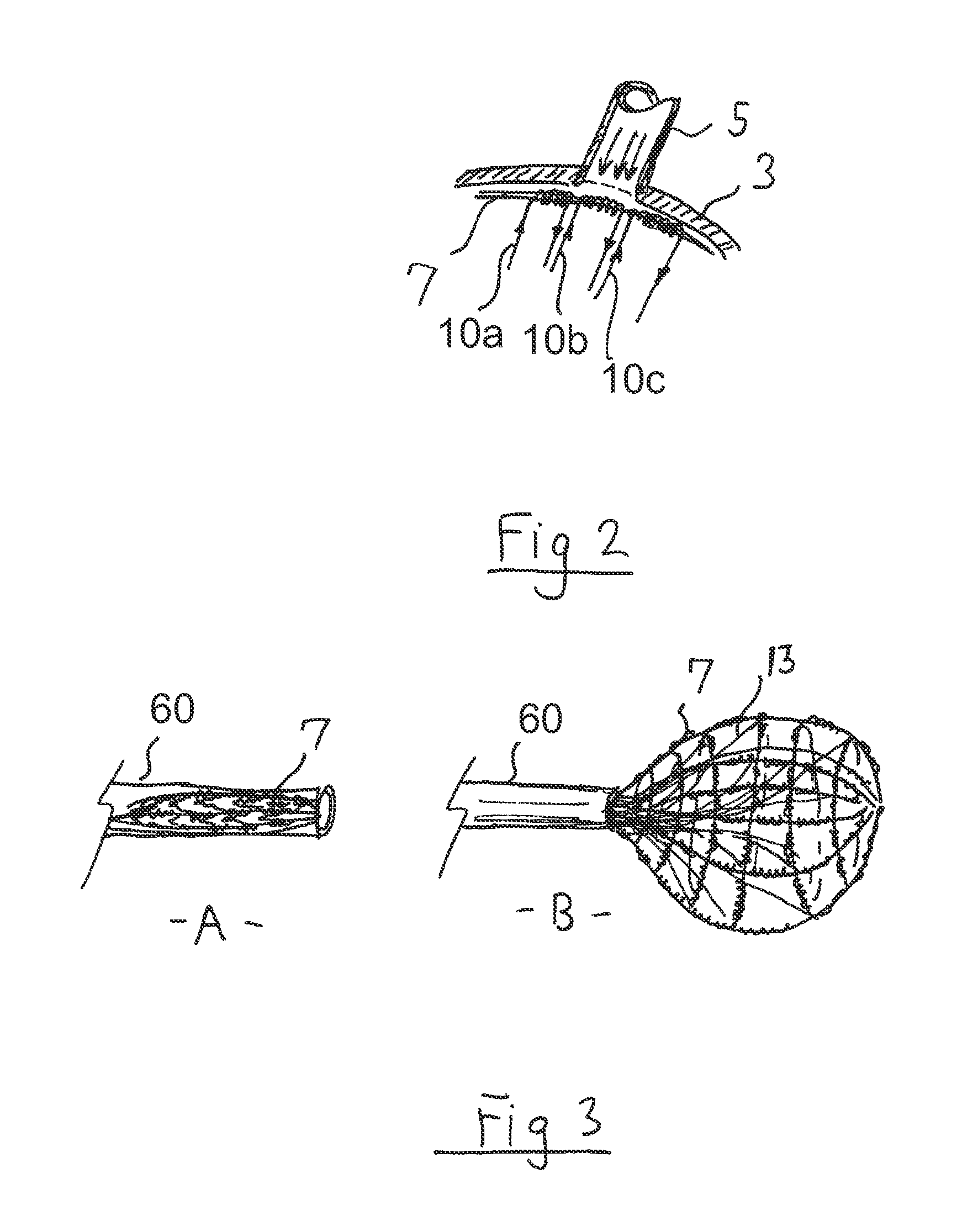 Apparatus and method for intra-cardiac mapping and ablation