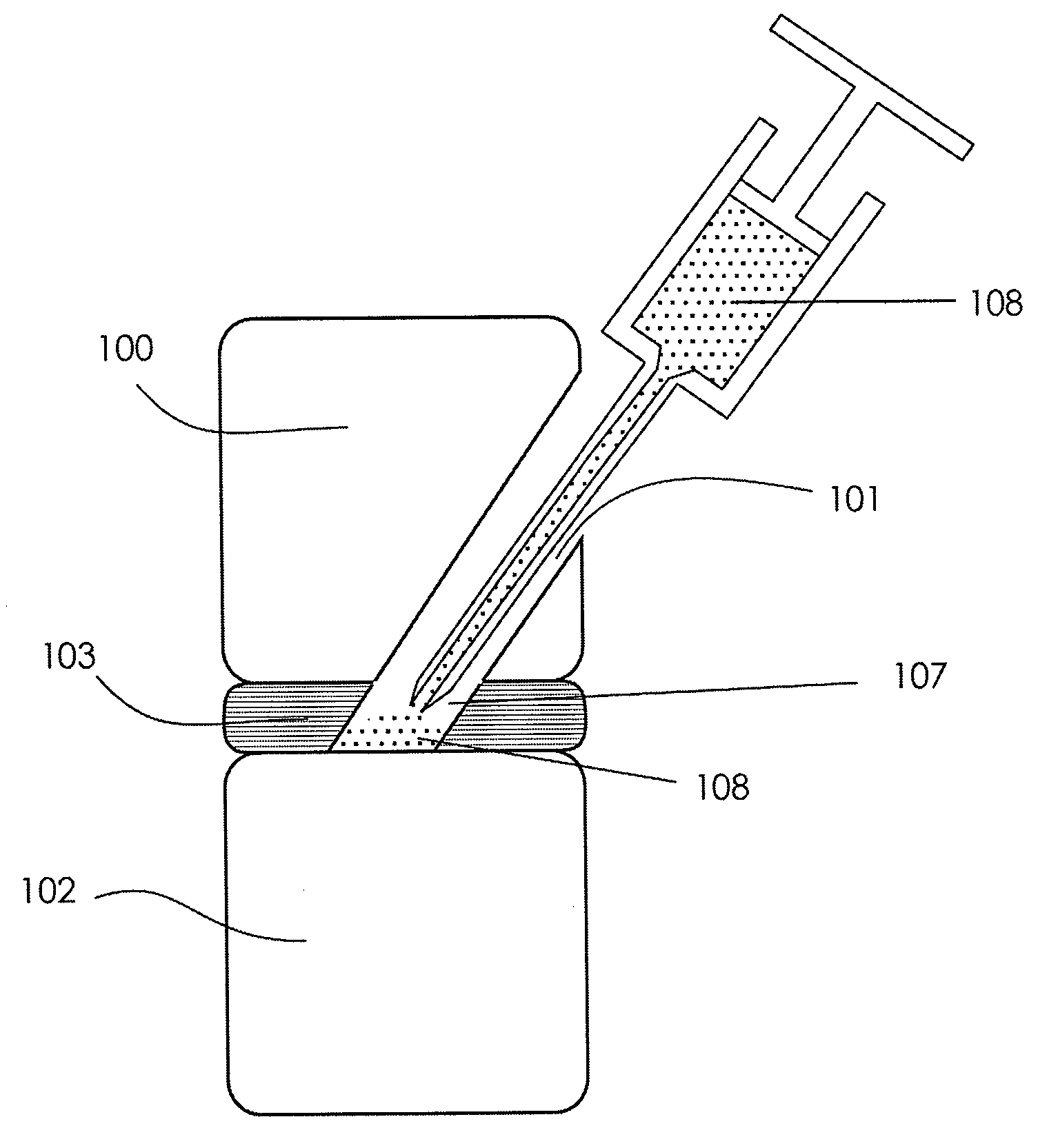 Methods and systems for repairing an intervertebral disc using a transcorporal approach