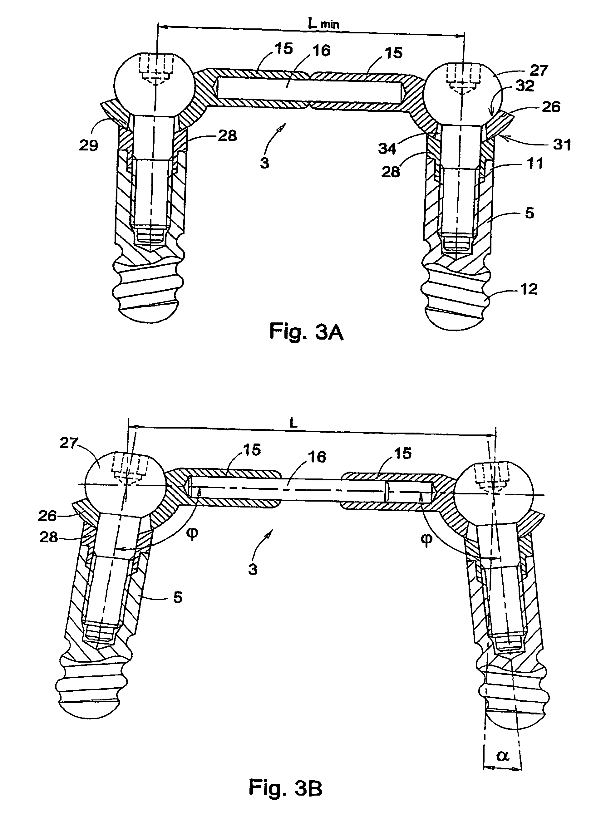 Fastening device for an orthesis or prosthesis