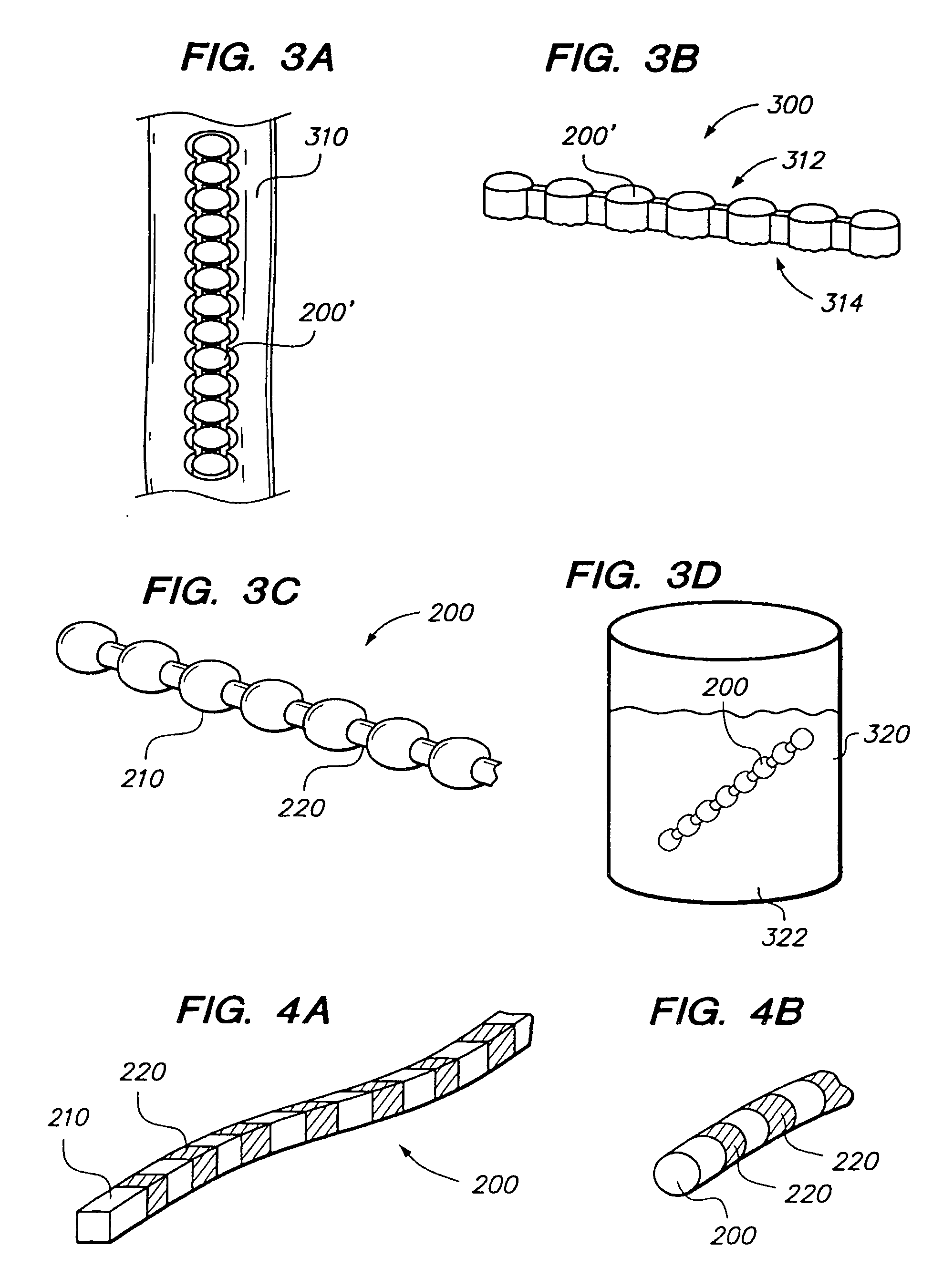 Flexible elongated chain implant and method of supporting body tissue with same