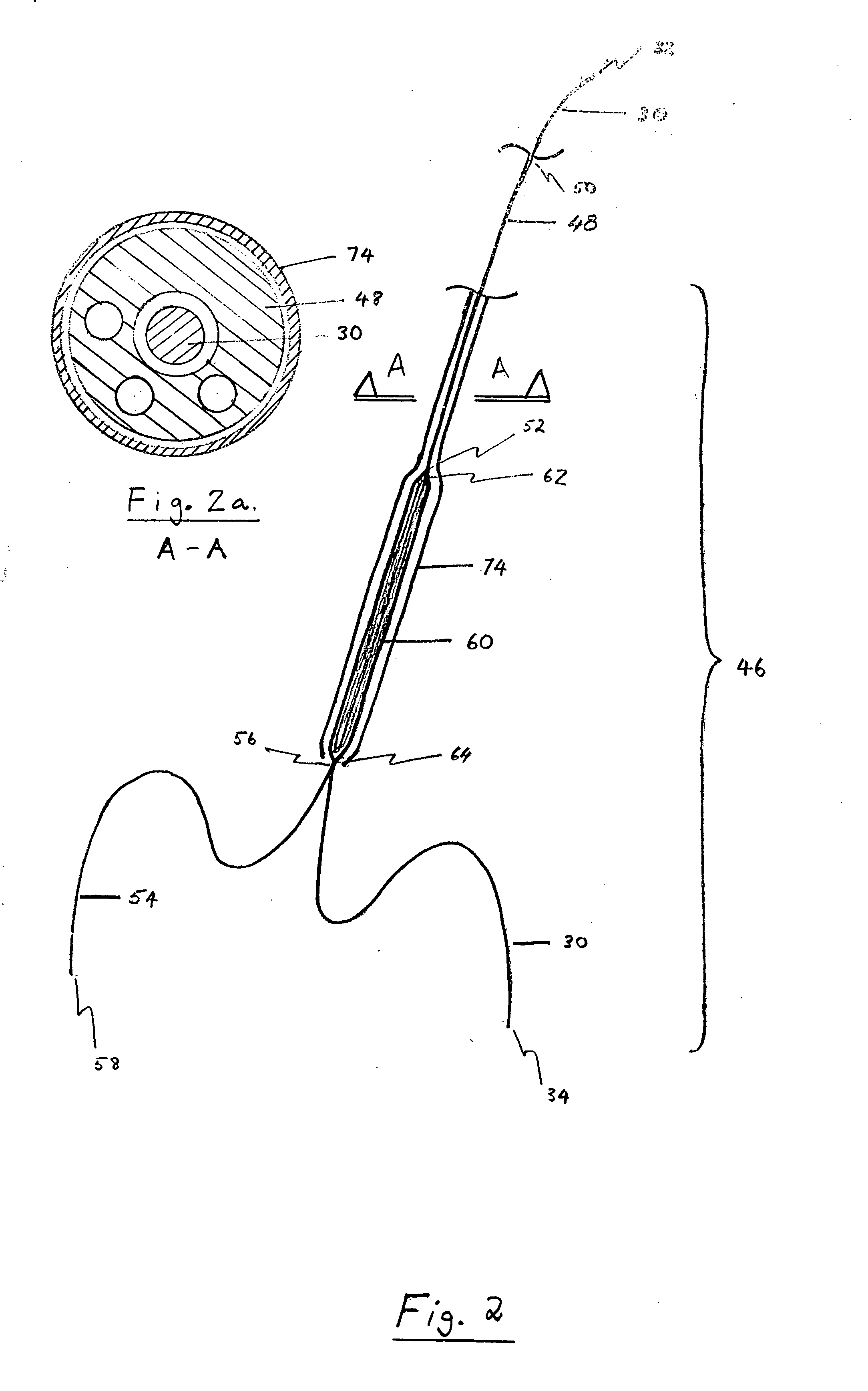 Device and method for staged implantation of a graft for vascular repair