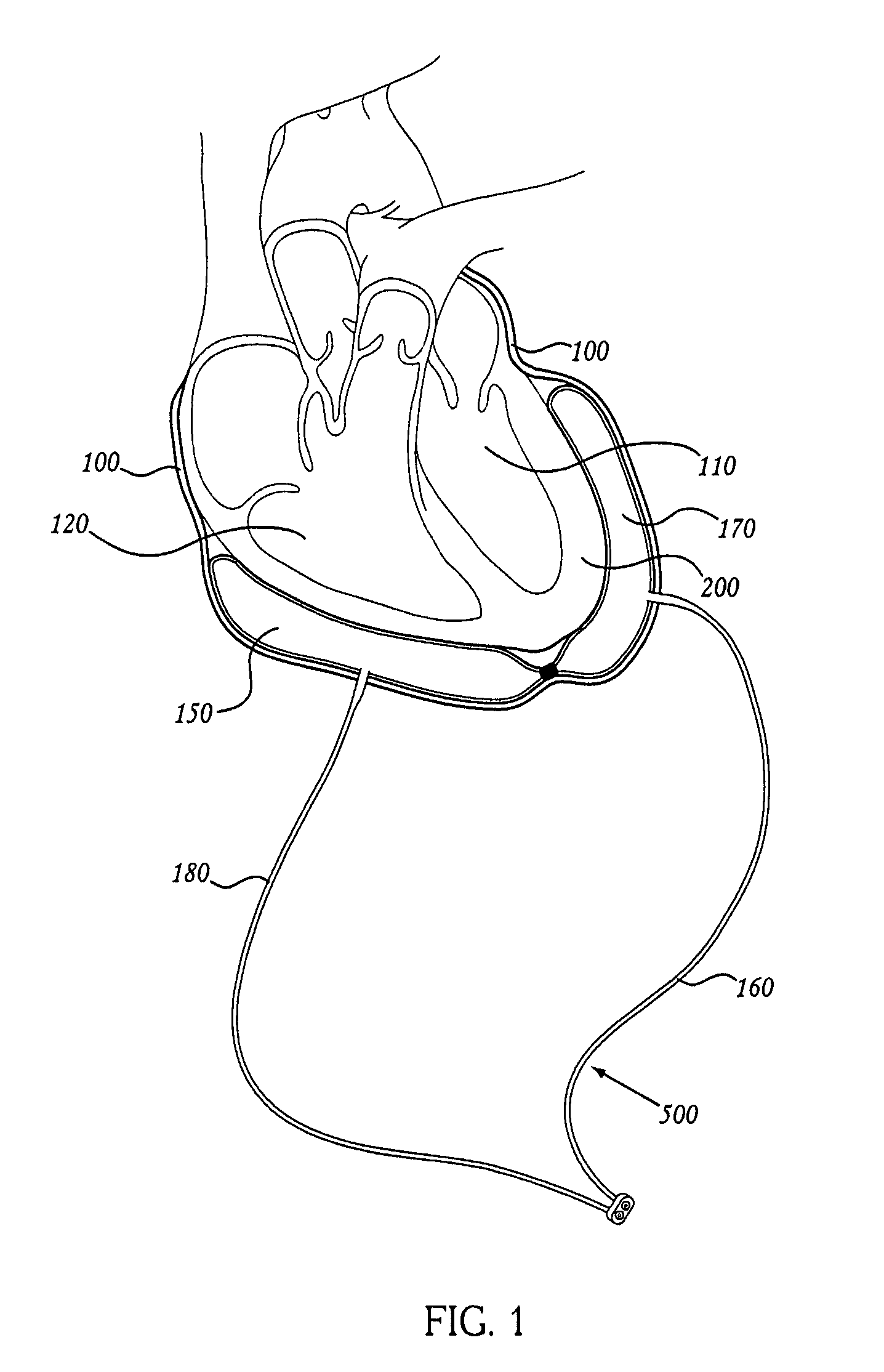 Methods of using pericardial inserts
