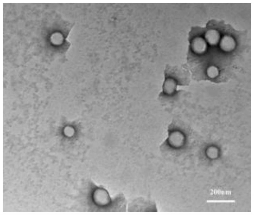 Modified zein nano-drug delivery system wrapped by outer membrane vesicles of bacteria as well as preparation method and application of modified zein nano-drug delivery system