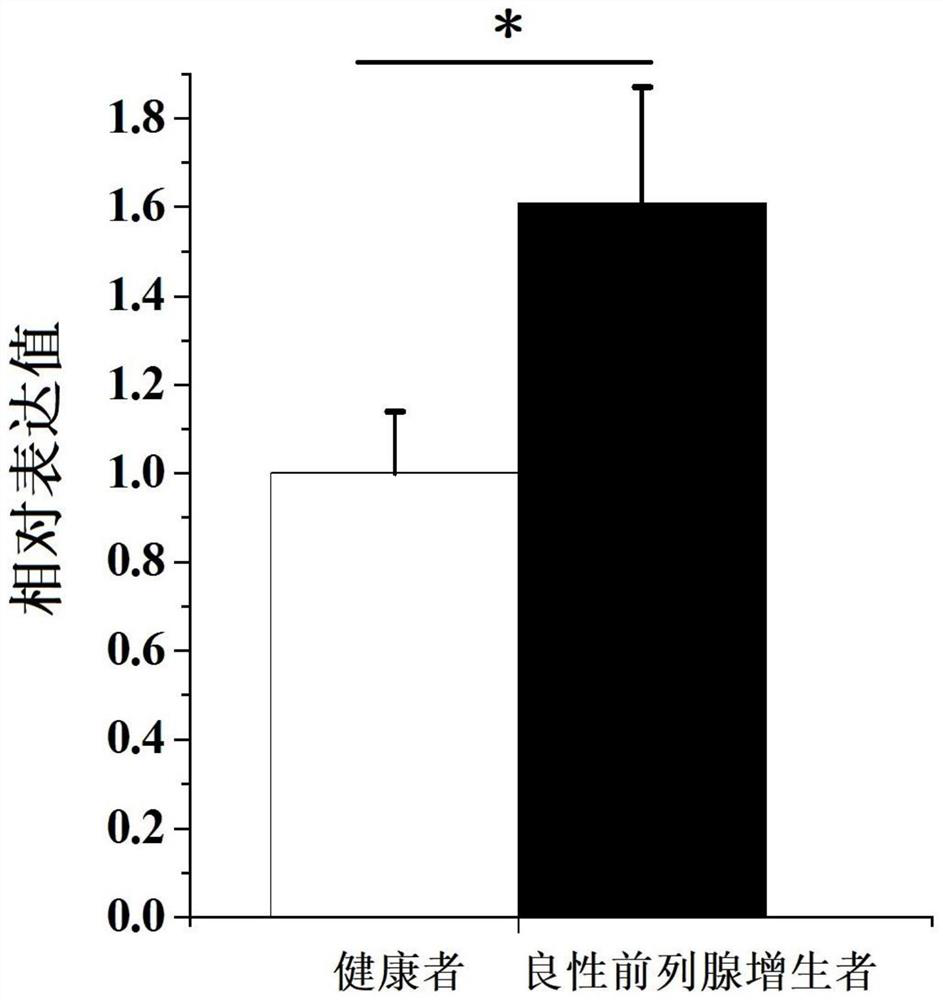 Application of exosome circular RNA 0109315 as target spot in prevention and treatment of benign prostatic hyperplasia