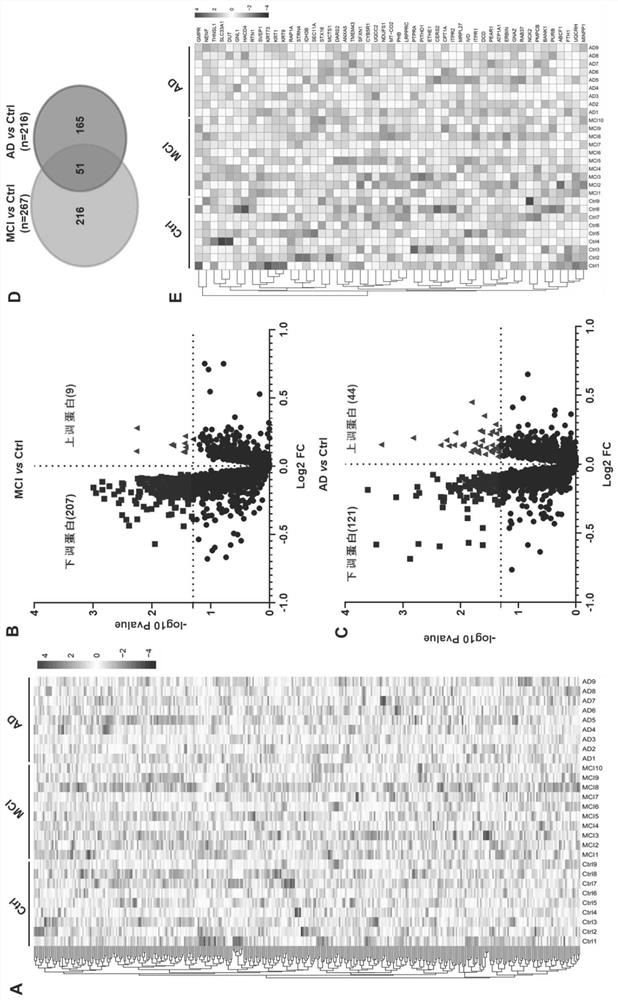 Biomarker and kit for predicting AD (Alzheimer's disease) risk of old people and application of biomarker and kit