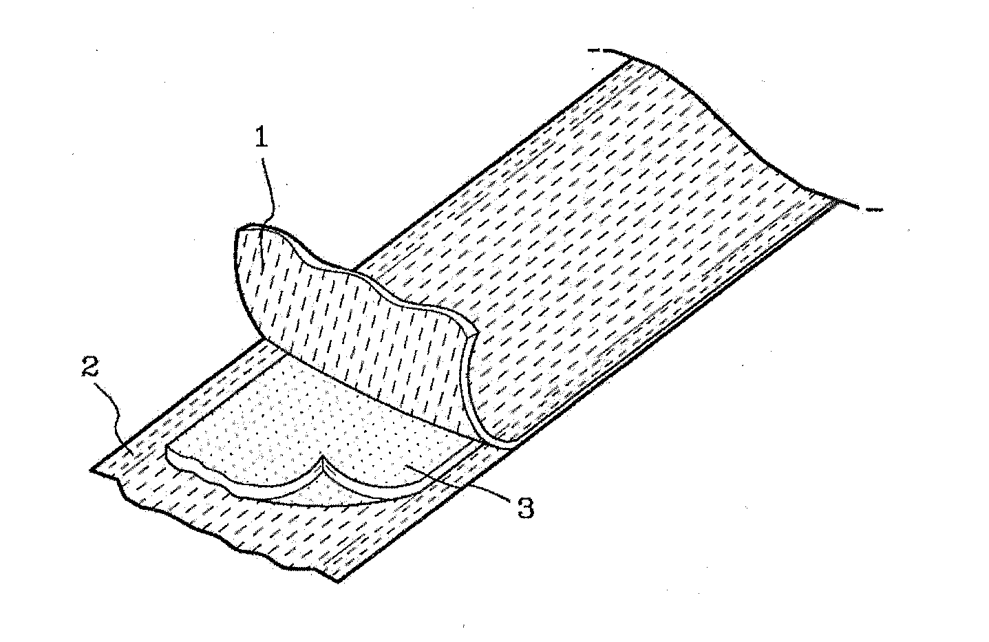 Splint for orthopedics