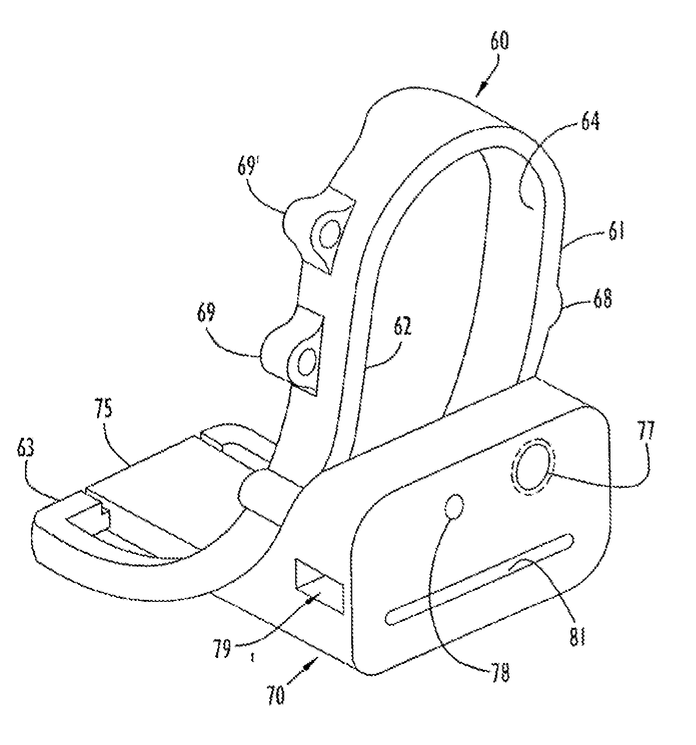 Instrumentation for Minimally Invasive Unicompartmental Knee Replacement