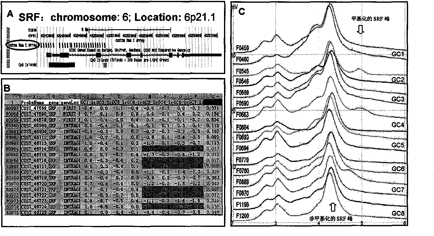 Method for predicting tumor metastasis and invasion capacity in vitro and nucleotide fragments