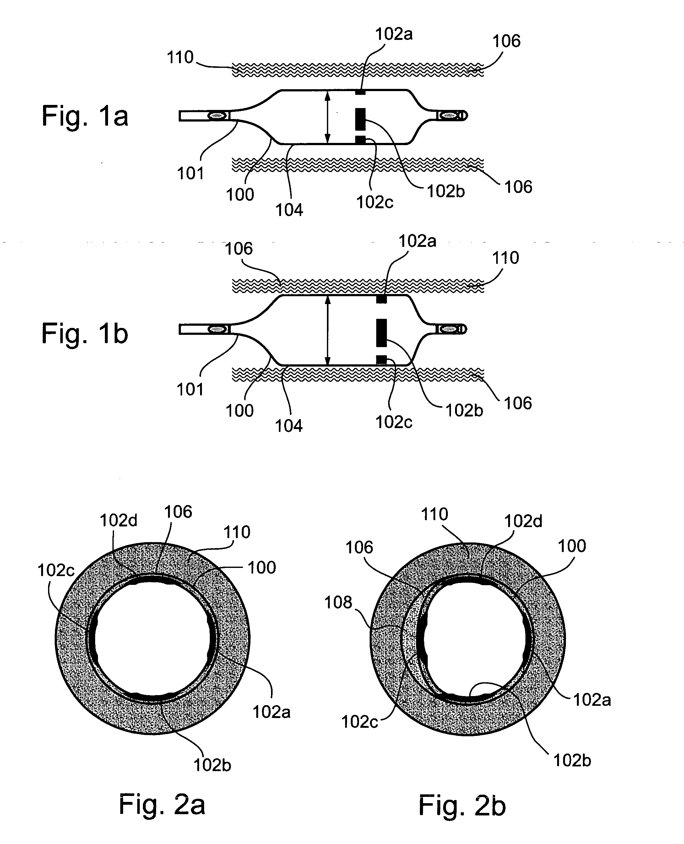 Device, system, and Method for detecting and localizing obstruction within a blood vessel