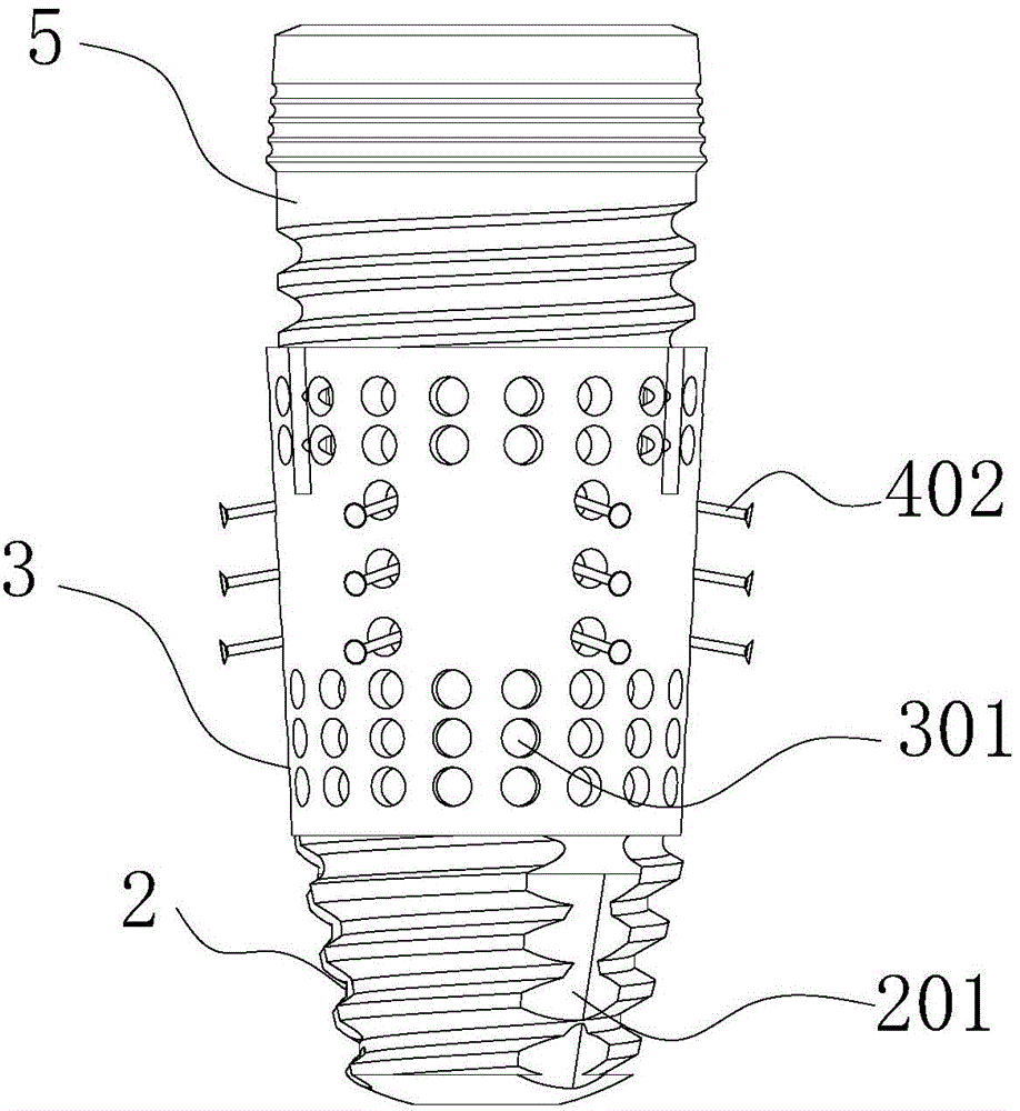 Dental implant of composite structure and manufacturing method of same