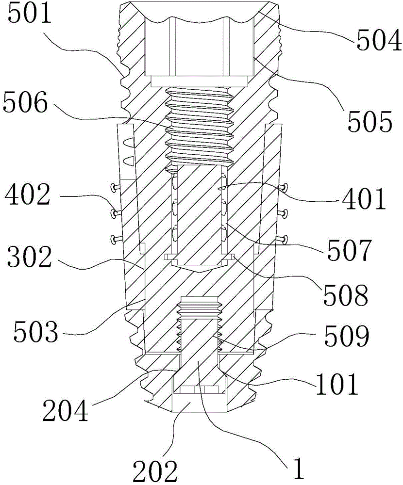 Dental implant of composite structure and manufacturing method of same