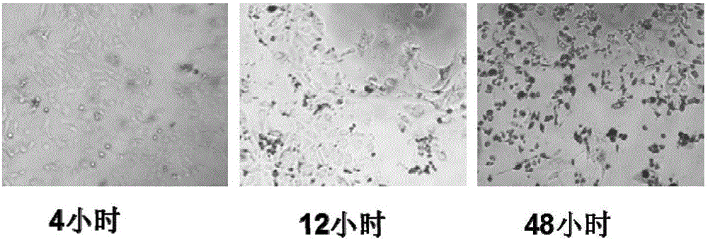 Method for preparing honeycomb silk fibroin porous microsphere sustained drug release vector
