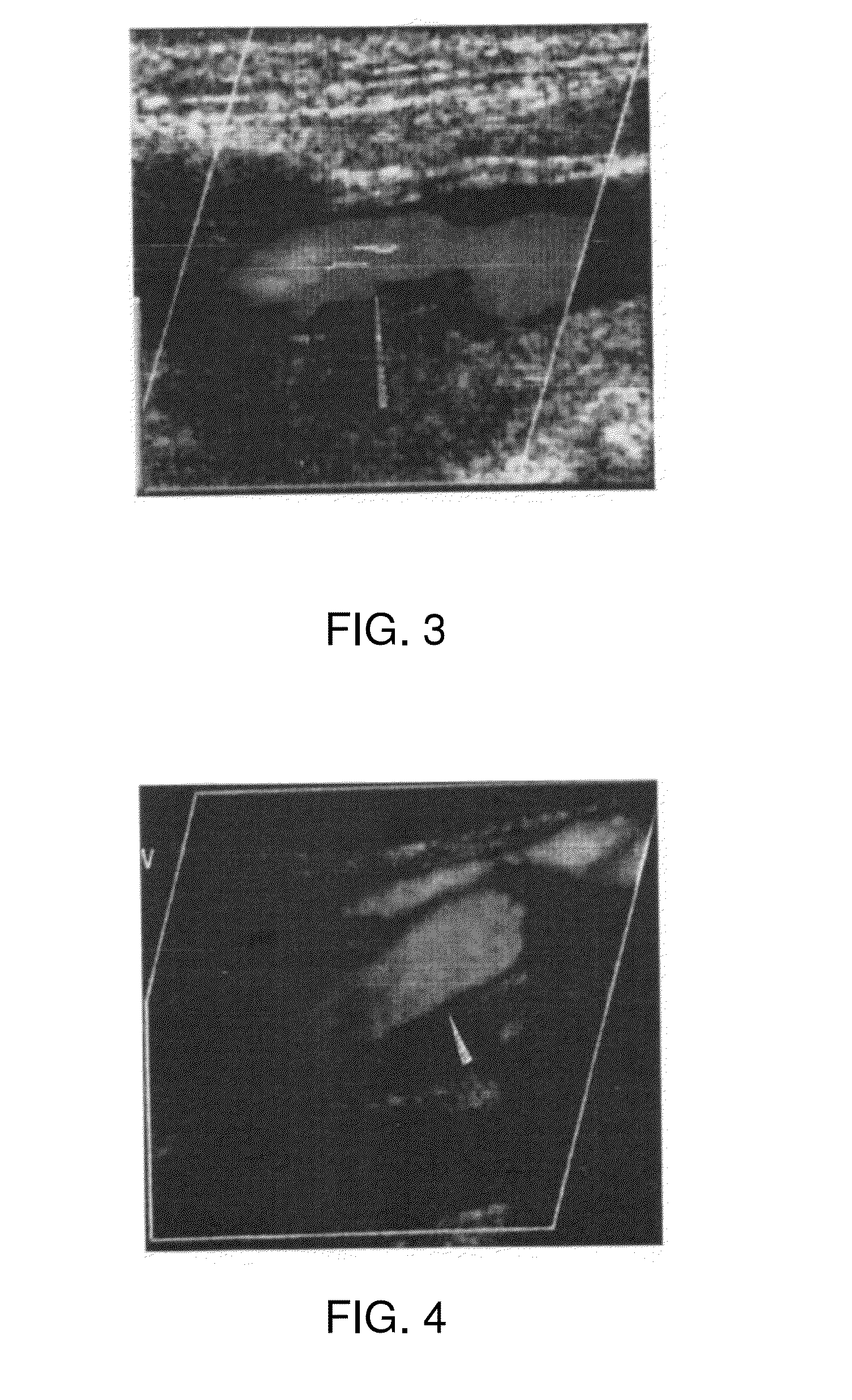 Herbal polypharmaceutical for preventing and treating atherosclerosis
