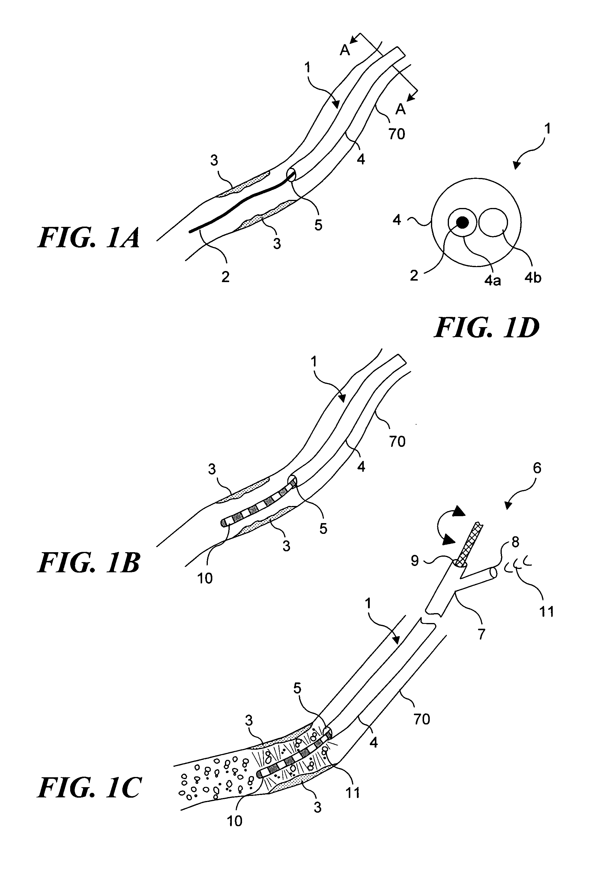 Light generating device that self centers within a lumen to render photodynamic therapy