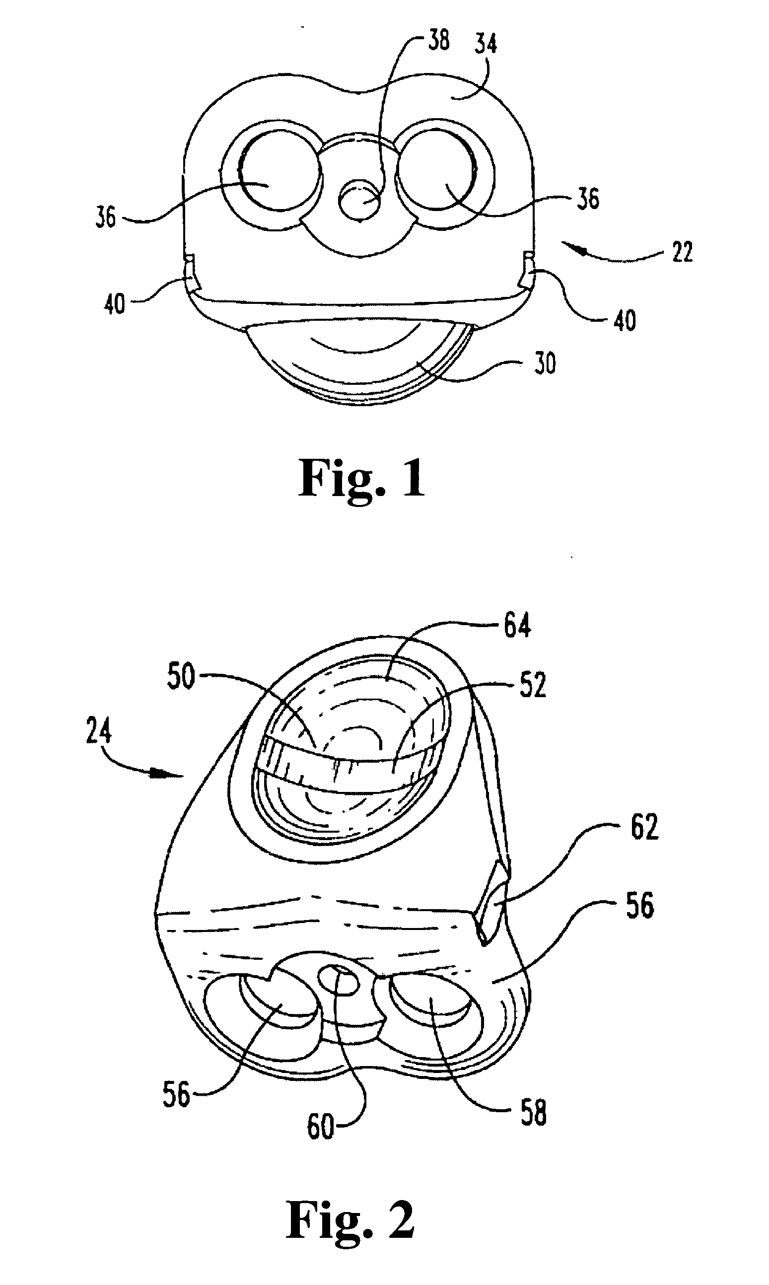 Articulating spinal disc implants with amorphous metal elements