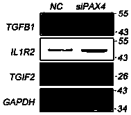 Application of PAX4 gene expression inhibitor to preparation of medicines for restraining fibrosis