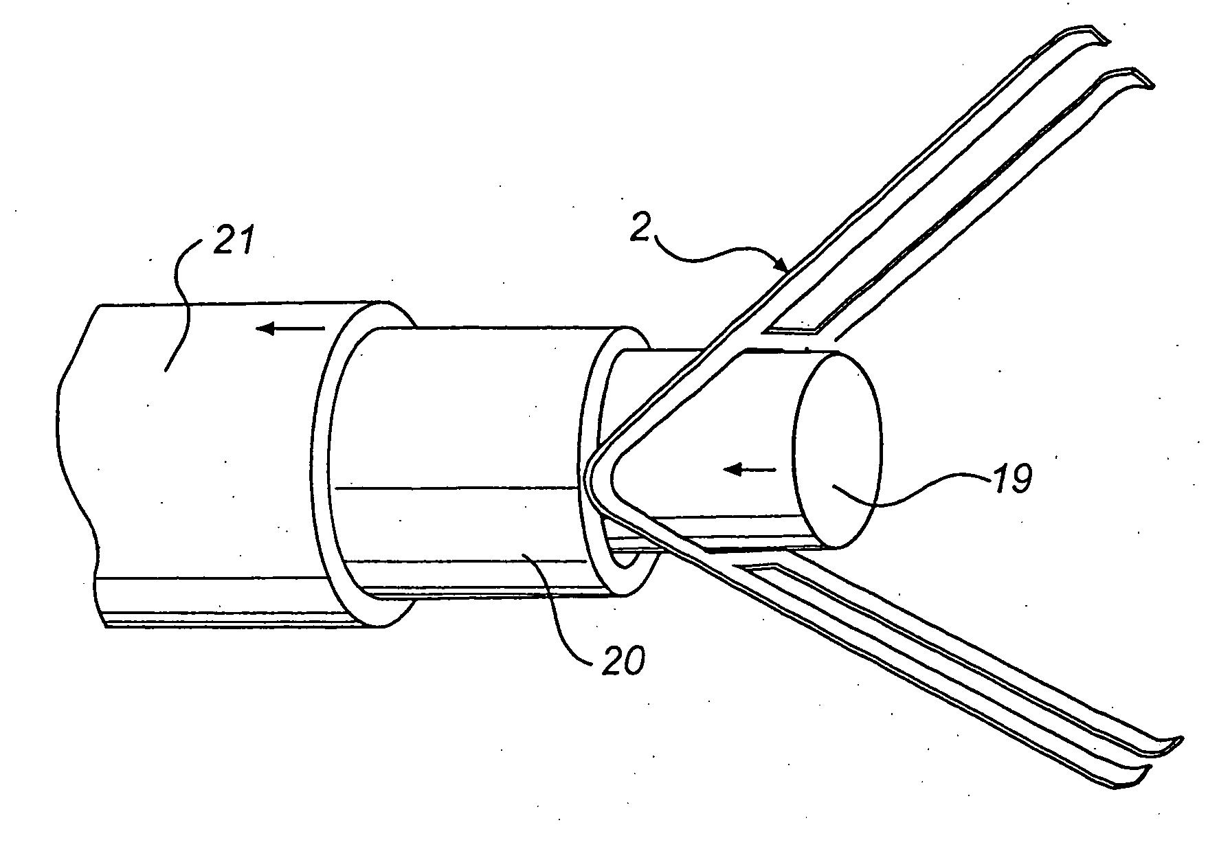 Device and a method for treatment of atrioventricular regurgitation