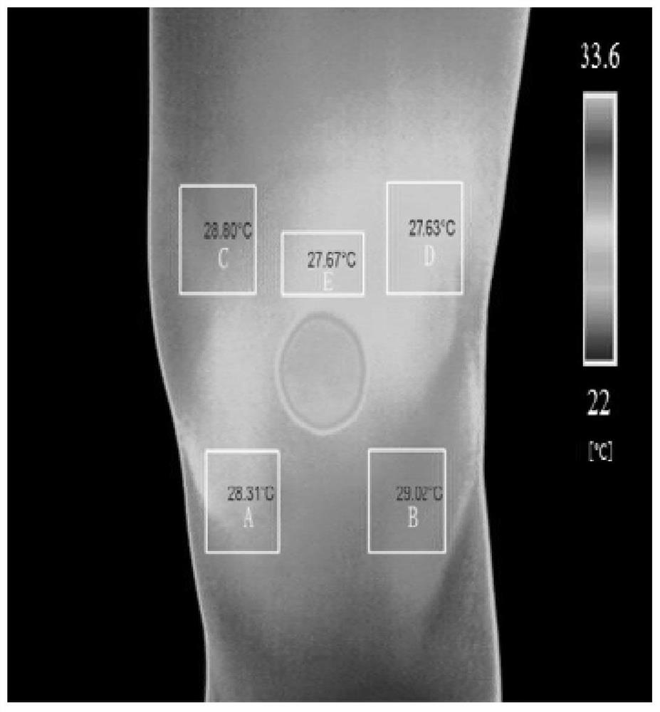 A remote diagnosis and treatment system for knee osteoarthritis based on infrared imaging