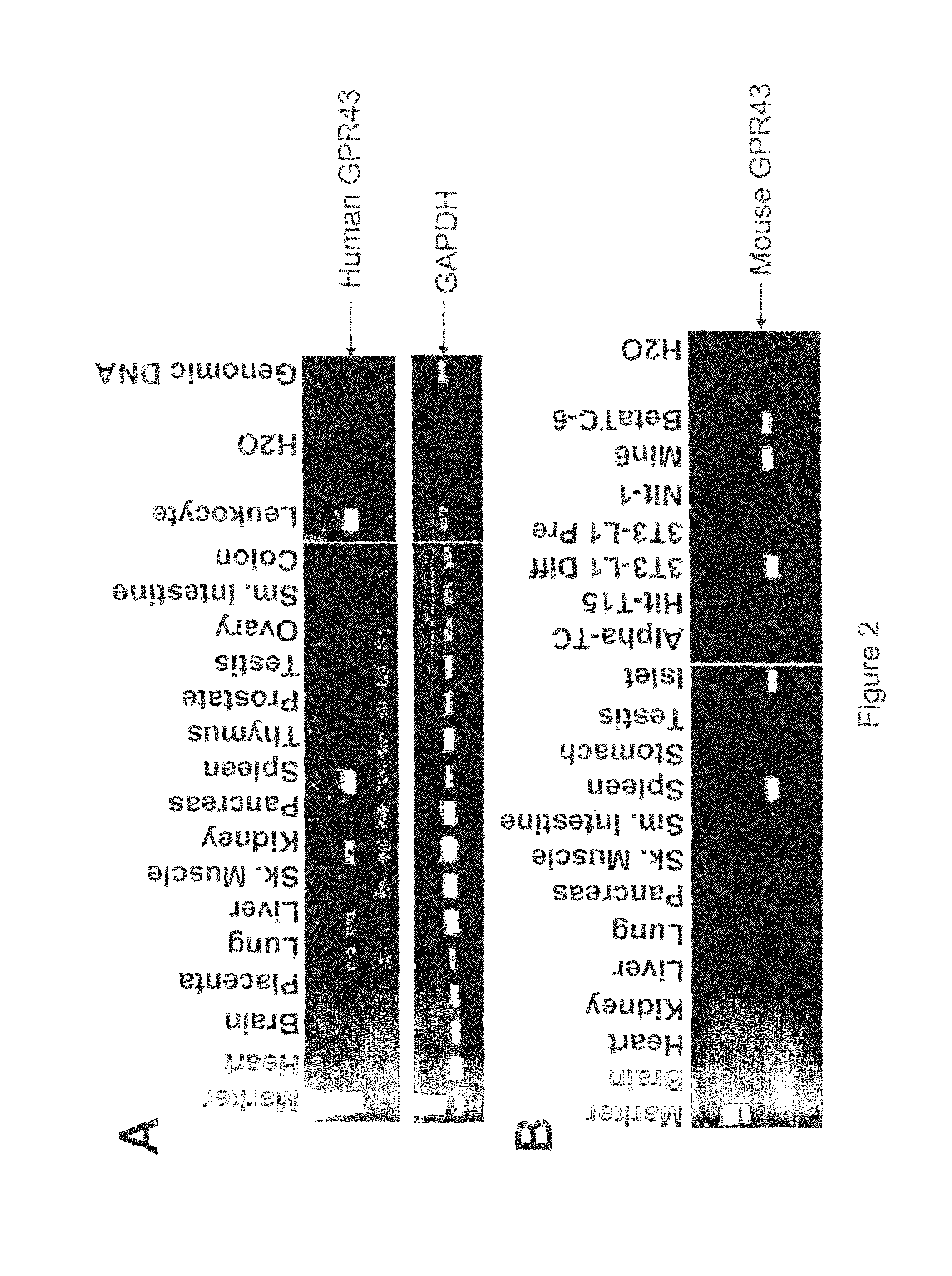 Method of screening for compounds useful in the treatment of insulin resistance, impaired glucose tolerance or diabetes