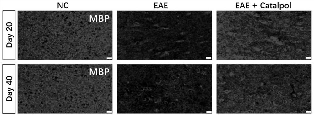 Application of catalpol in treatment of optic neuritis