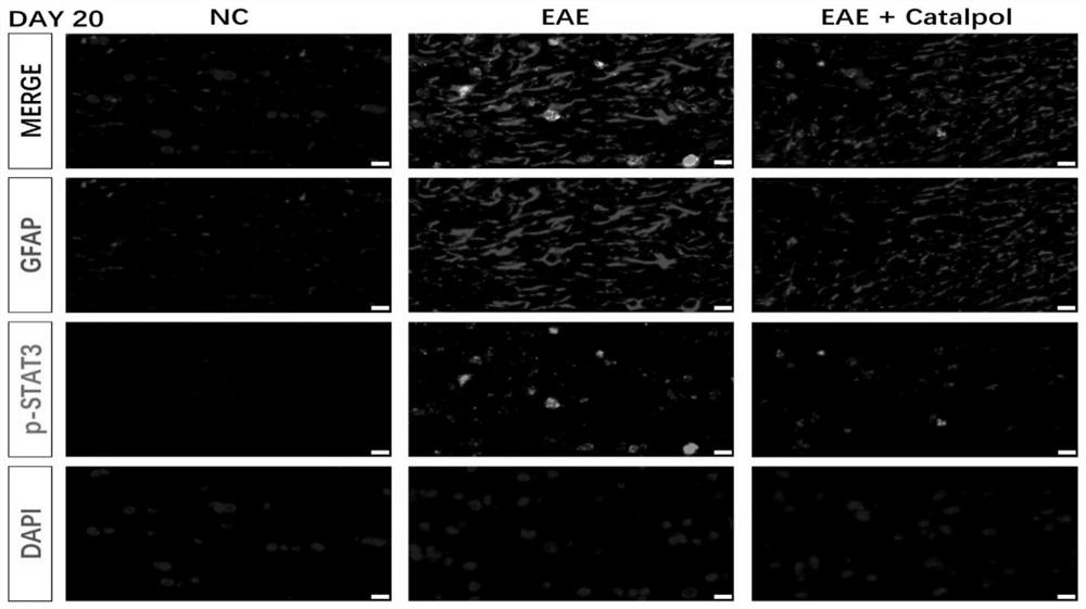 Application of catalpol in treatment of optic neuritis