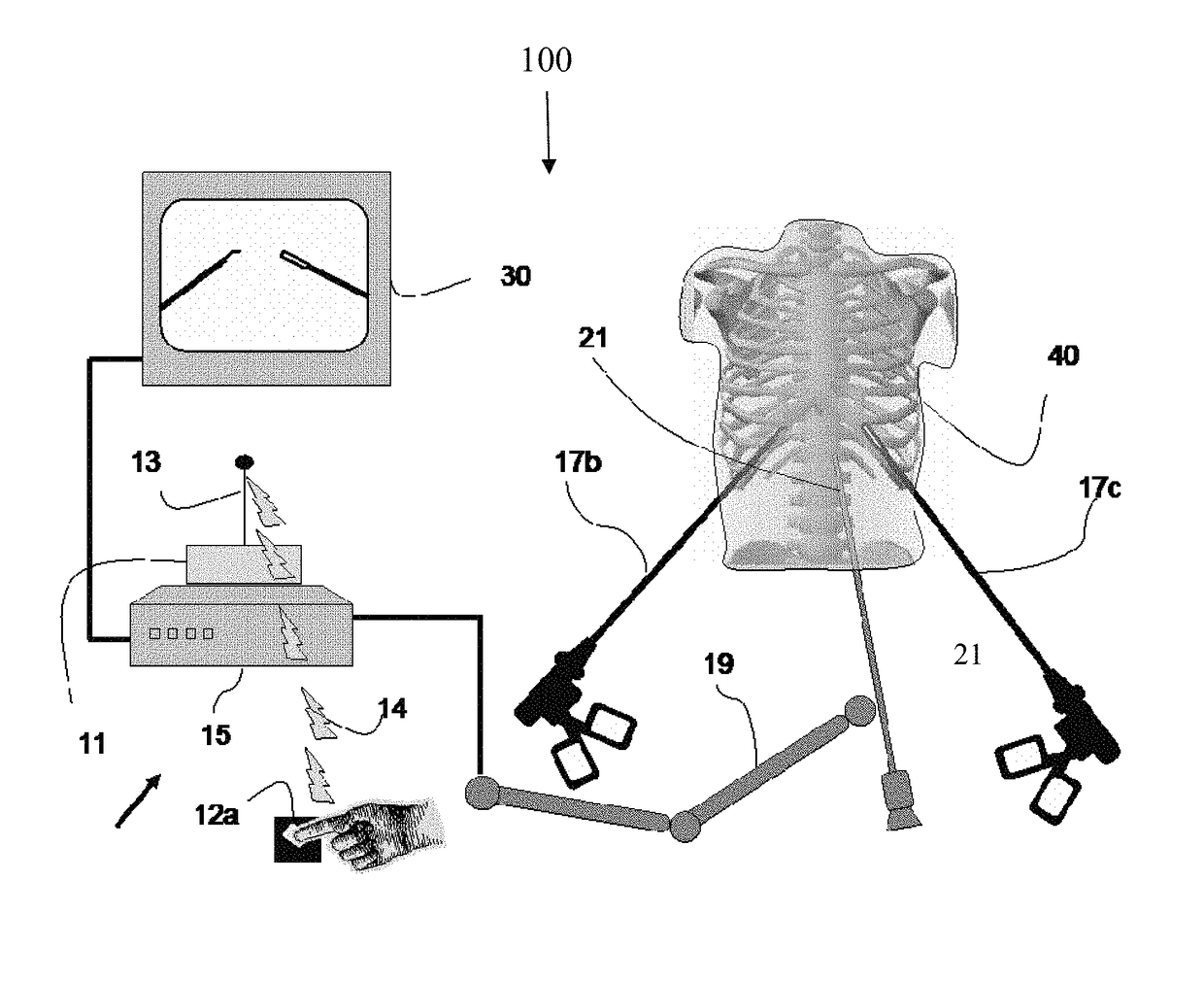 Device and method for assisting laparoscopic surgery—rule based approach