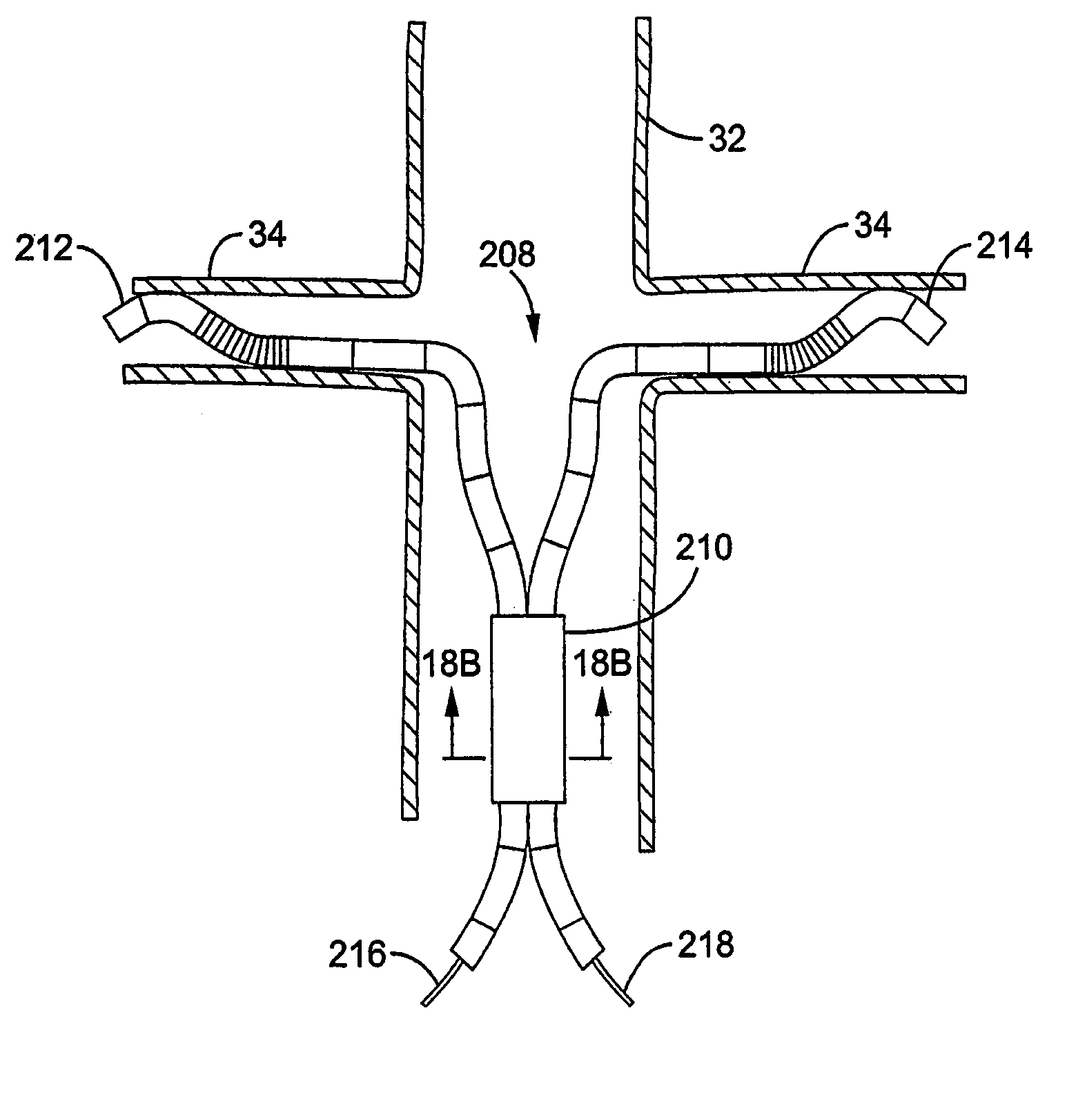 Systems and methods for performing bi-lateral interventions or diagnosis in branched body lumens