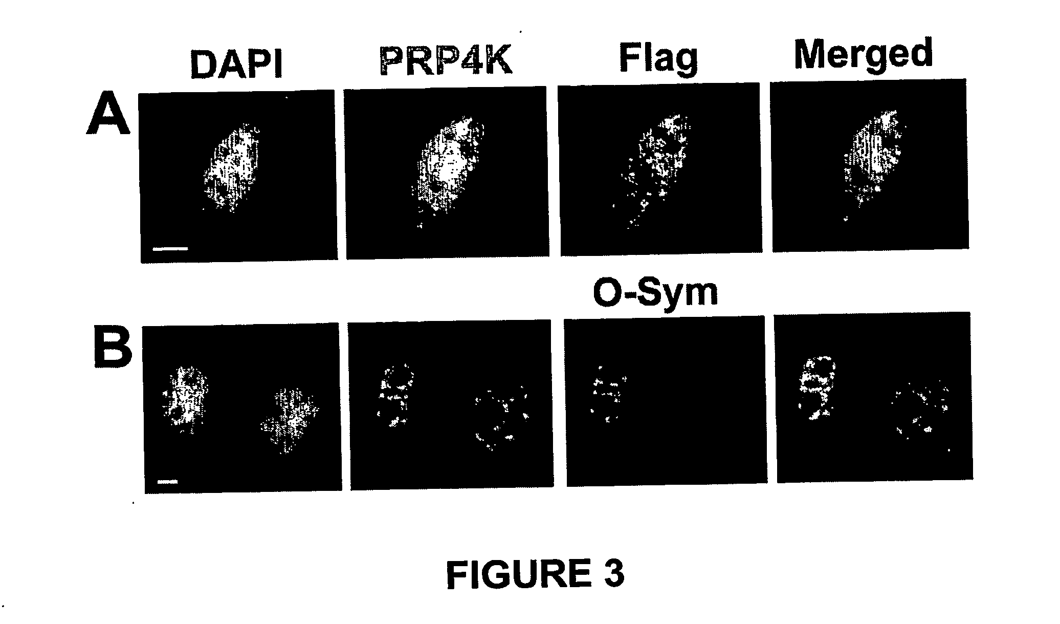 Method of in situ detection of proteins using aptamers