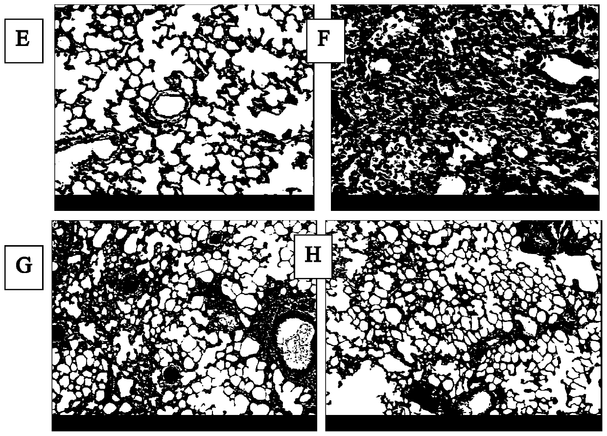 Use of a recombinant human cell line protein in the preparation of drugs for preventing or treating pulmonary fibrosis