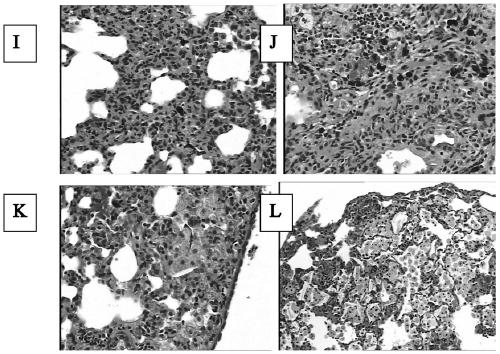 Use of a recombinant human cell line protein in the preparation of drugs for preventing or treating pulmonary fibrosis