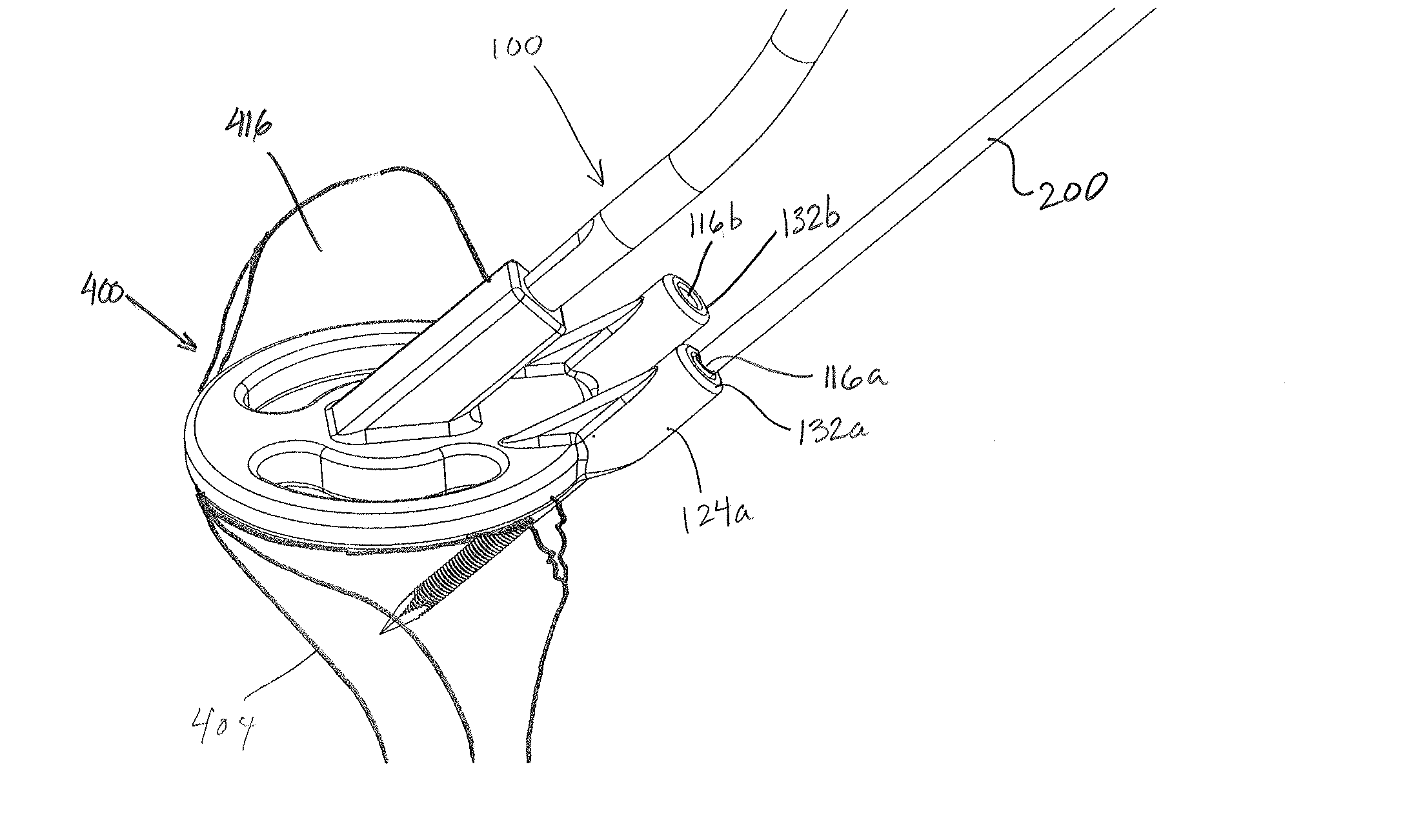 Devices, apparatuses, kits, and methods for repair of articular surface and/or articular rim