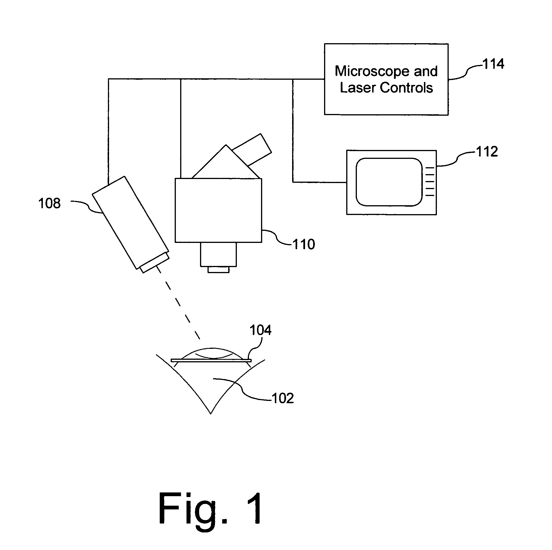 Method of treatment of ocular compartment syndromes