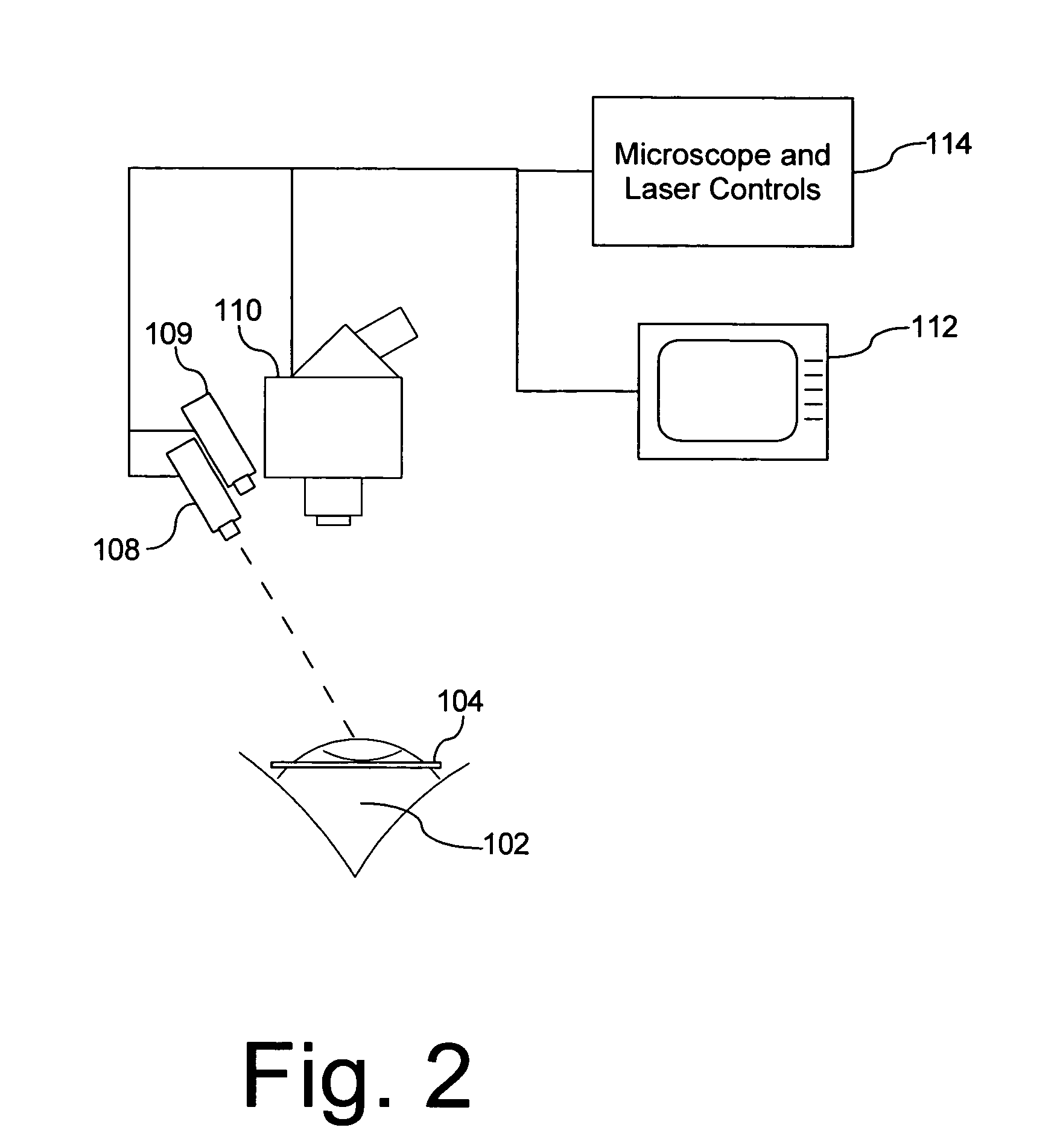 Method of treatment of ocular compartment syndromes