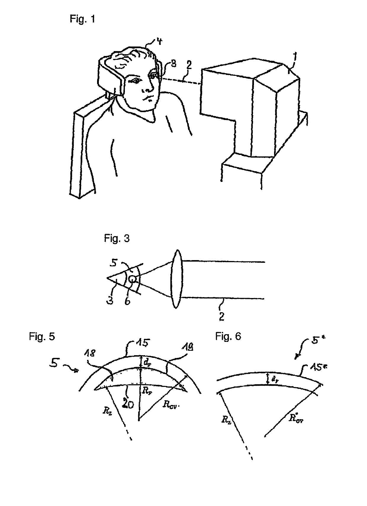 Treatment device for the surgical correction of defective vision of an eye, method for producing control data therefor, and method for the surgical correction of defective vision of an eye