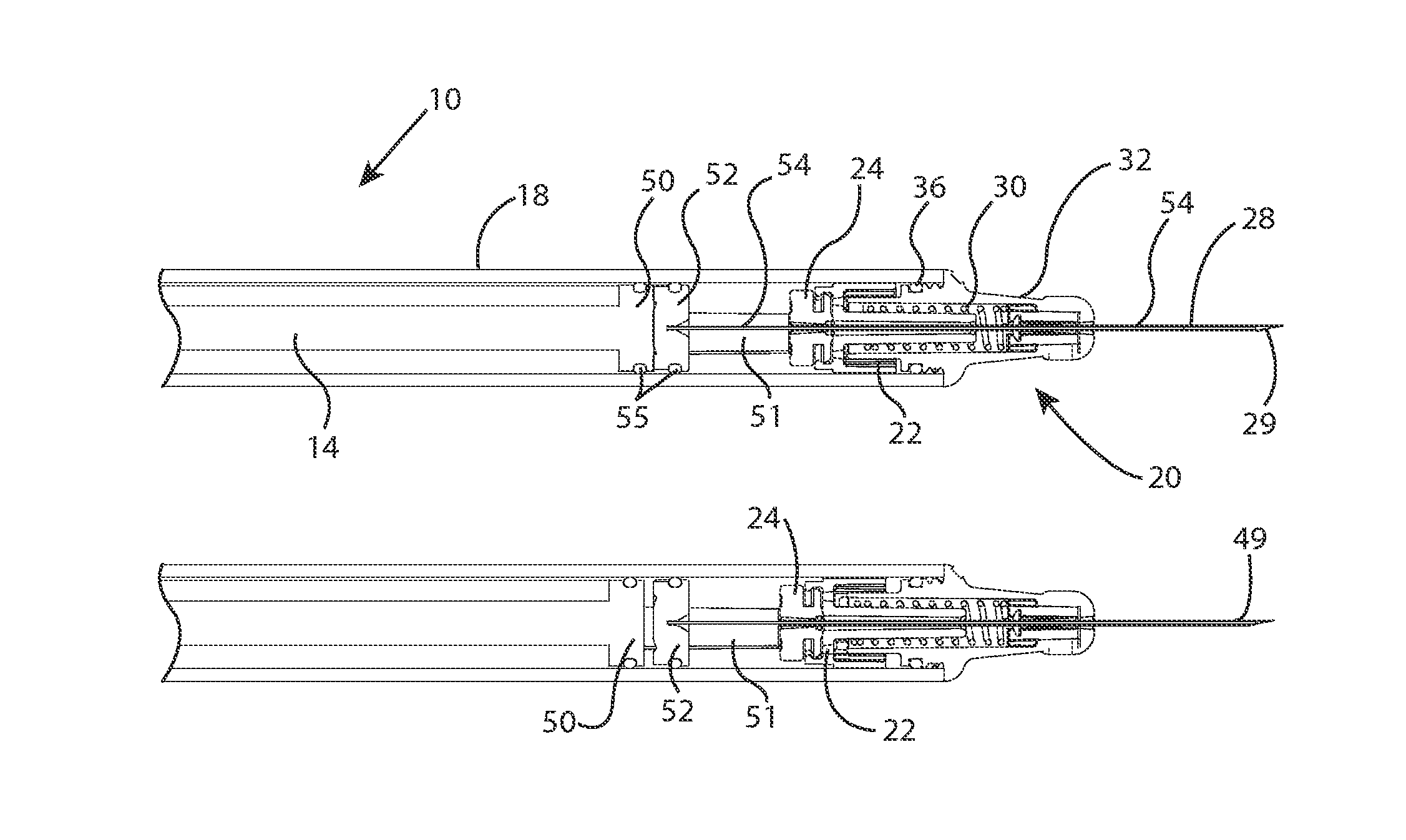 Devices for targeted delivery of therapeutic implants
