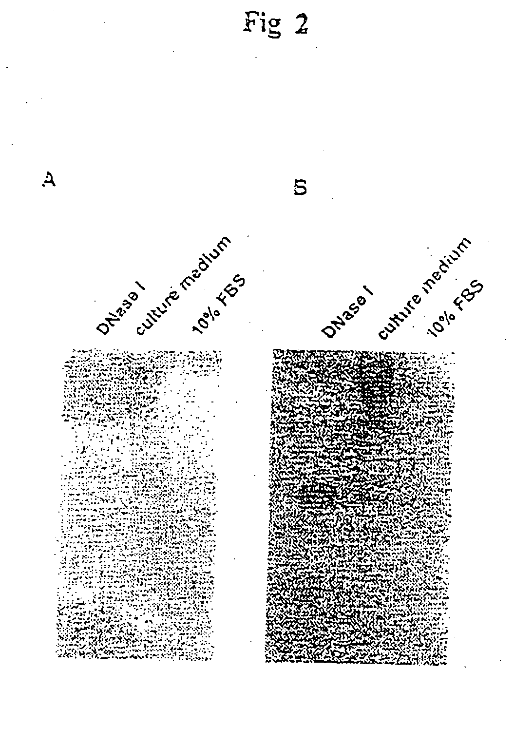 Novel endonuclease of immune cell, process for producing the same and immune adjuvant using the same