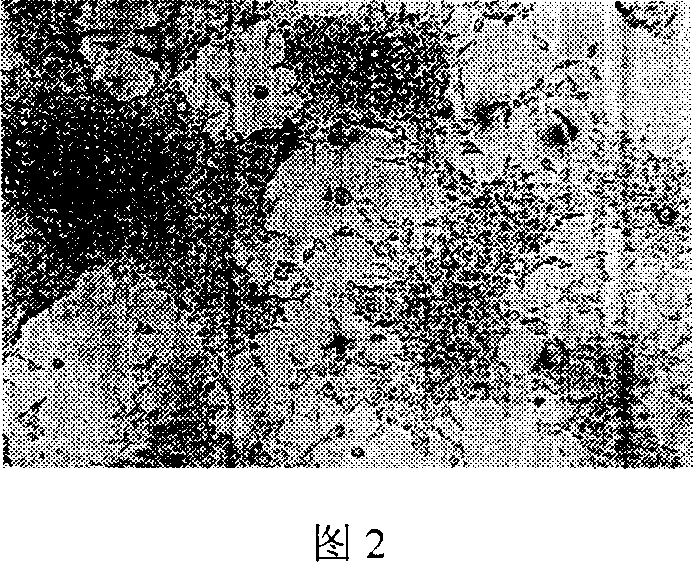 Snake venom polypeptide and its preparation method