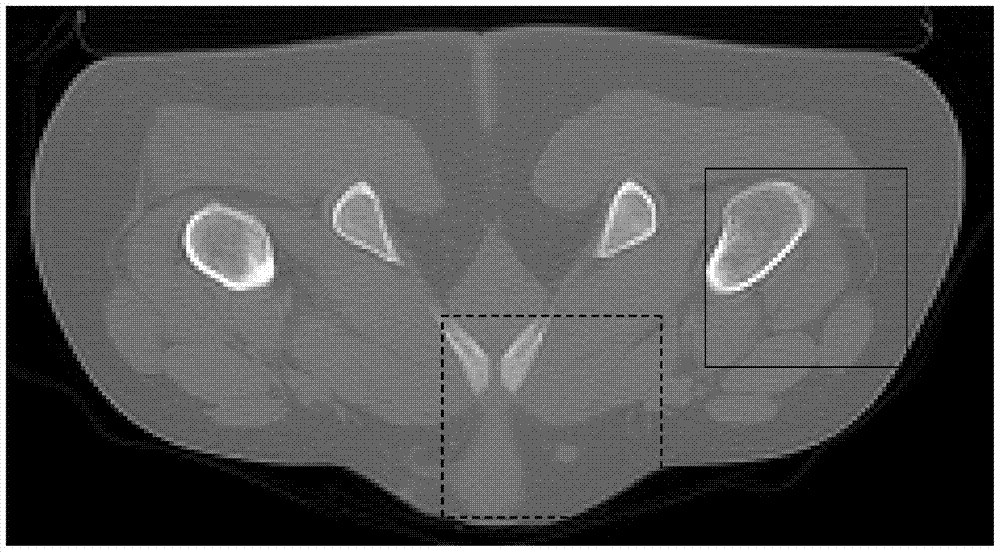 Sparse Angular CT Image Reconstruction Method Based on Gamma Prior