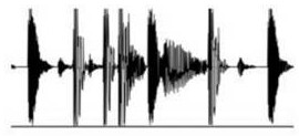 Audio start point detection method and device