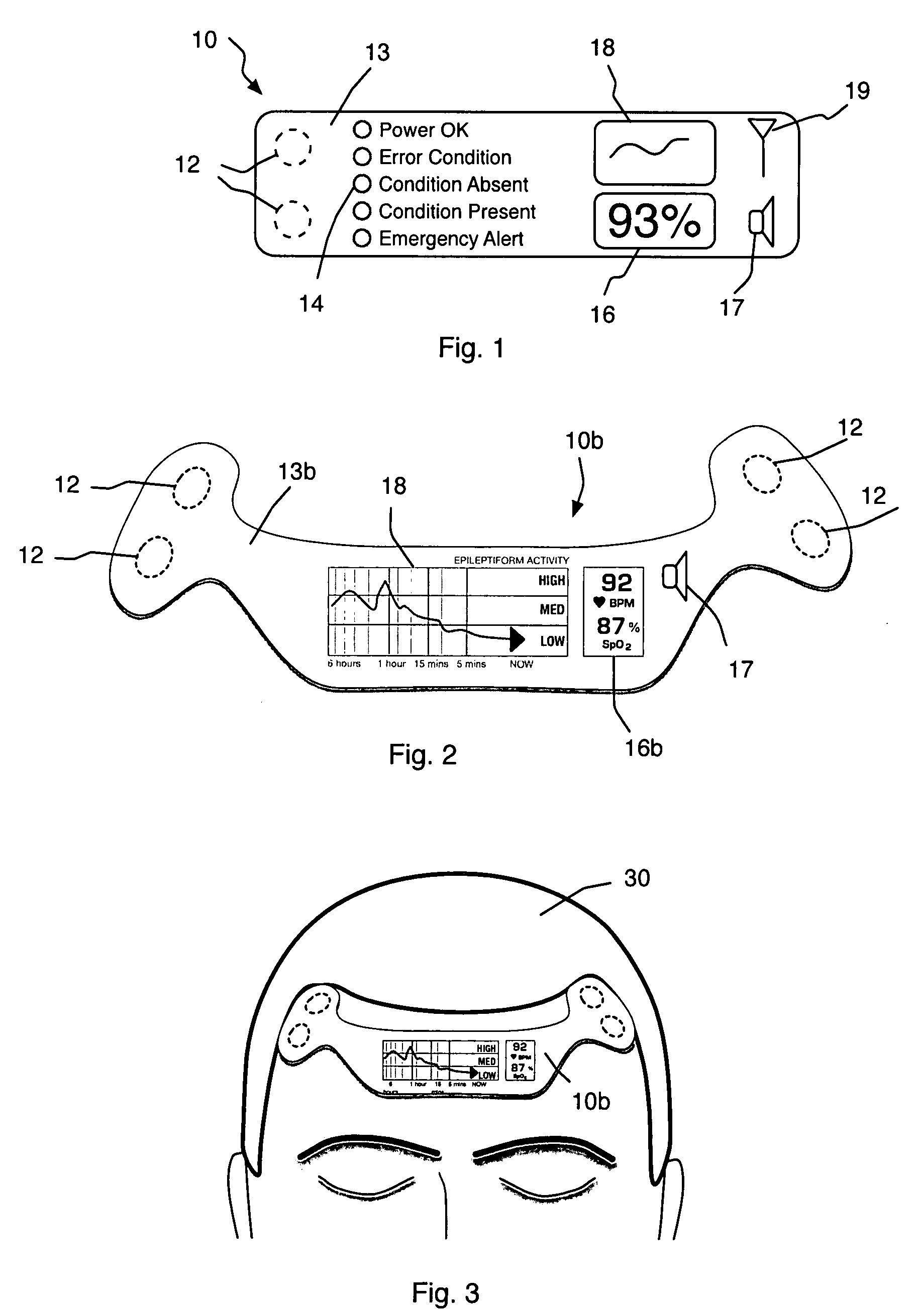 Self-contained surface physiological monitor with adhesive attachment