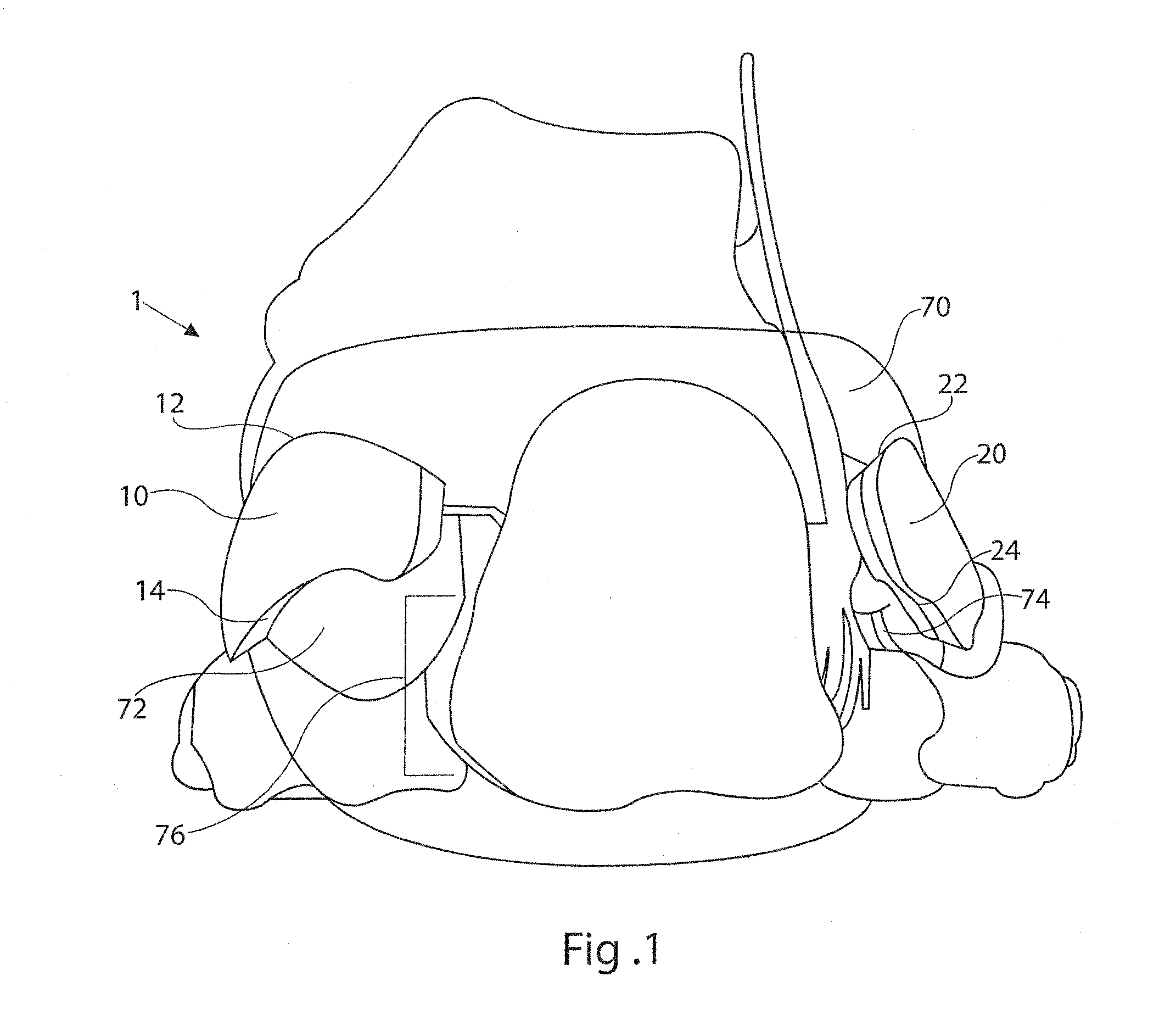 Heel stabilizer for footwear